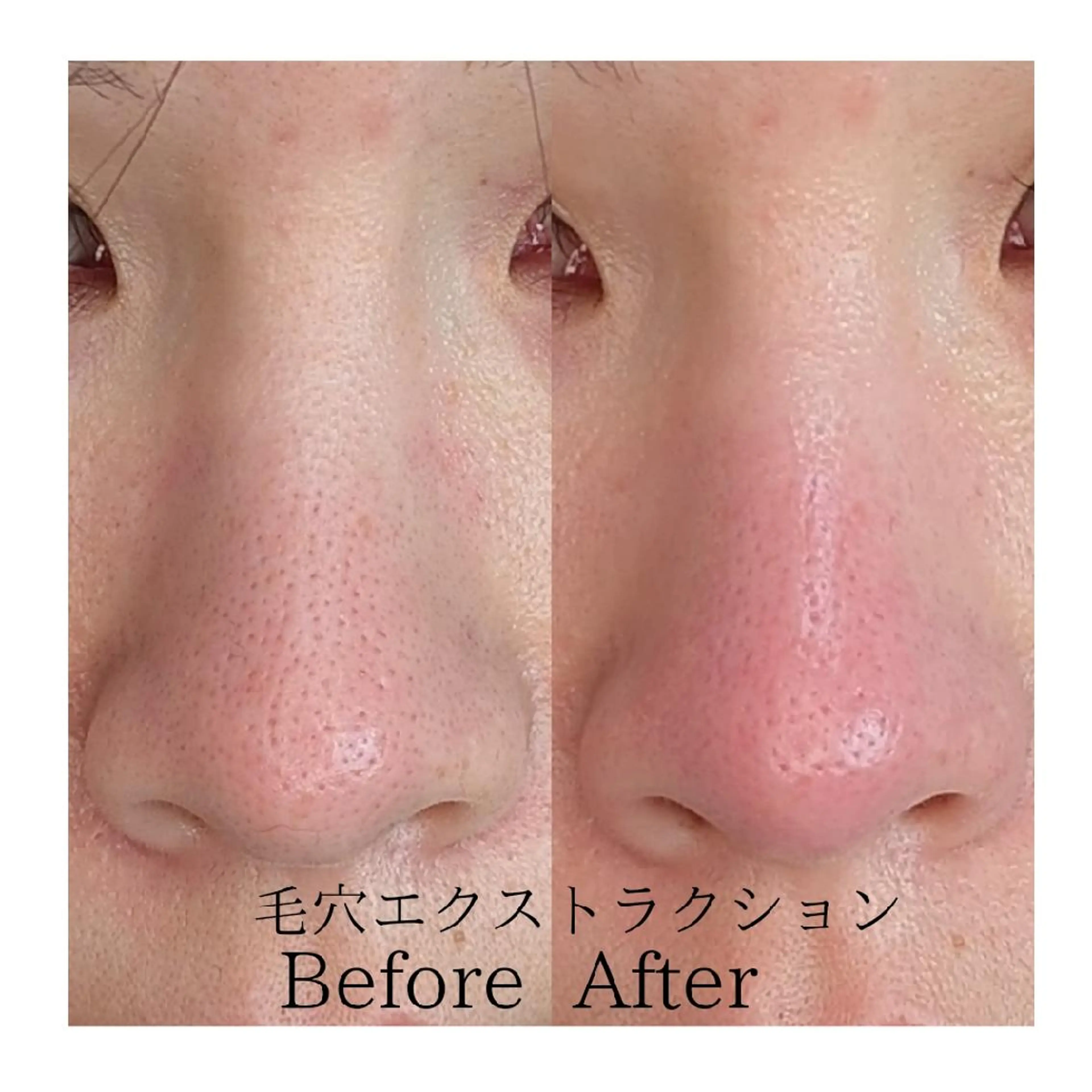  毛穴洗浄・まつ毛 の専門店 ソラーレのエステ・リラクイメージ