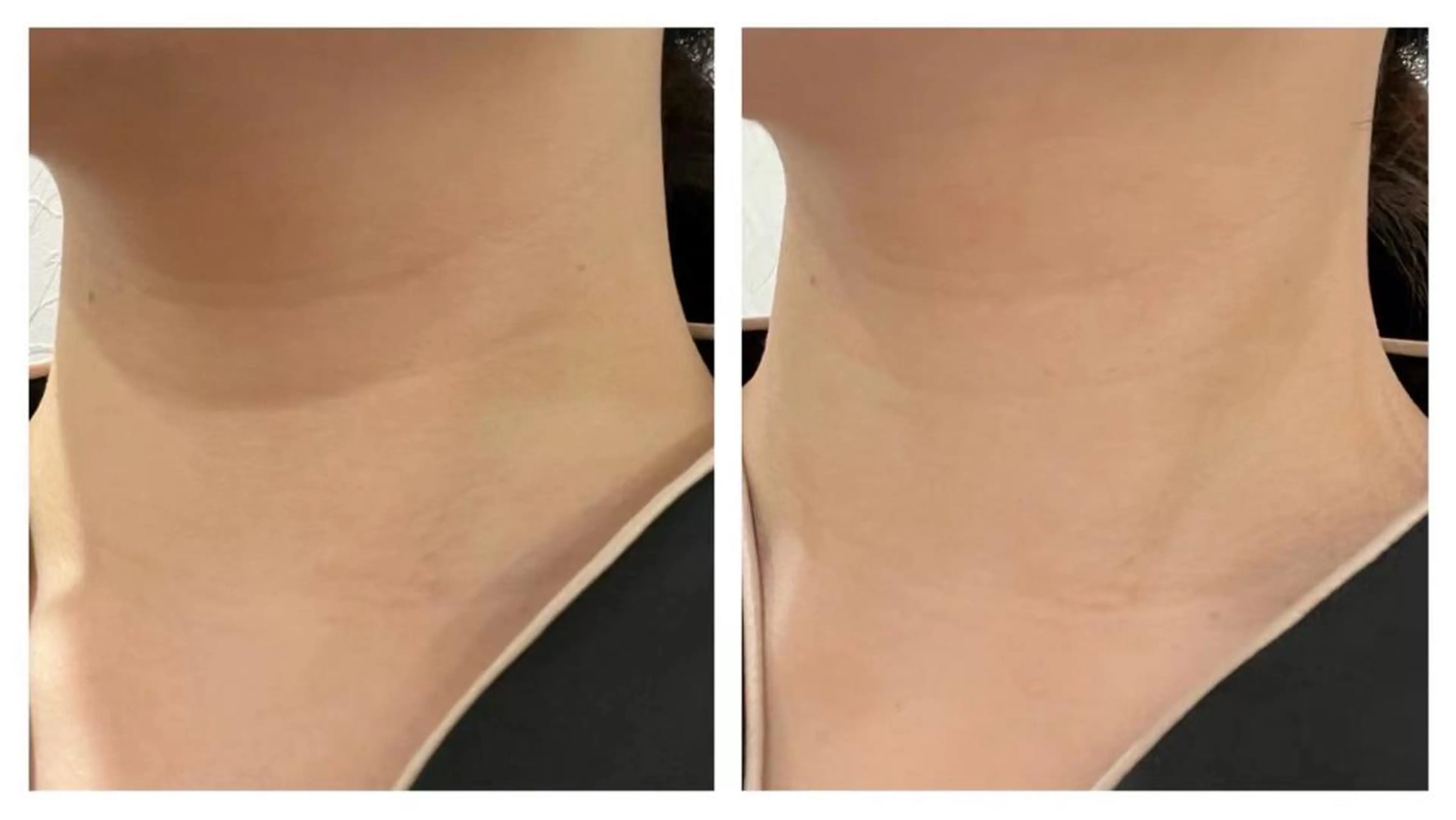 西区九条エステ MITUREIサロンのエステ・リラクイメージ