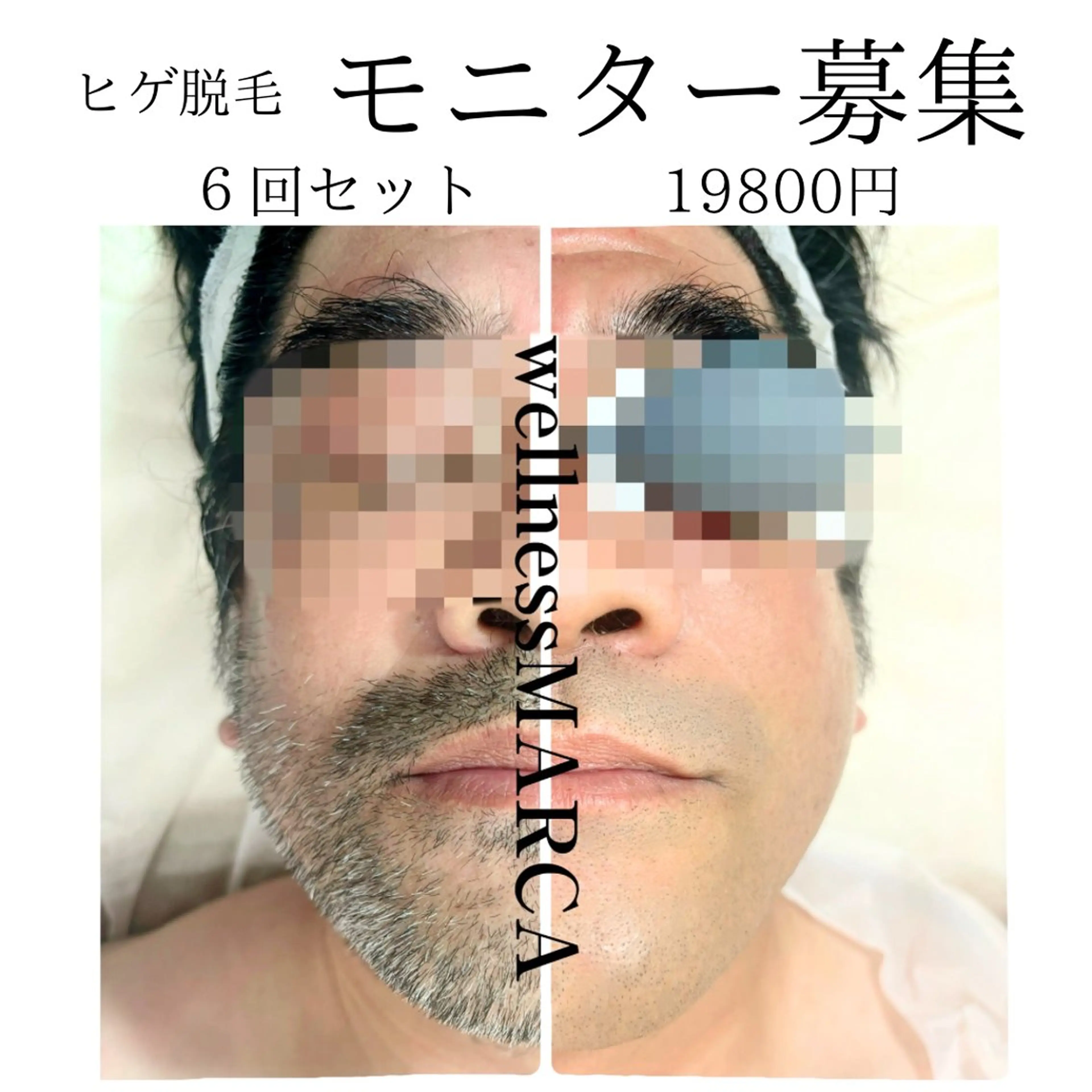 メンズ ネイル メンズネイル メンズトータルビューティーwellnessMARCA所属・【メンズ美容】 三浦かえでのエステ・リラクイメージ