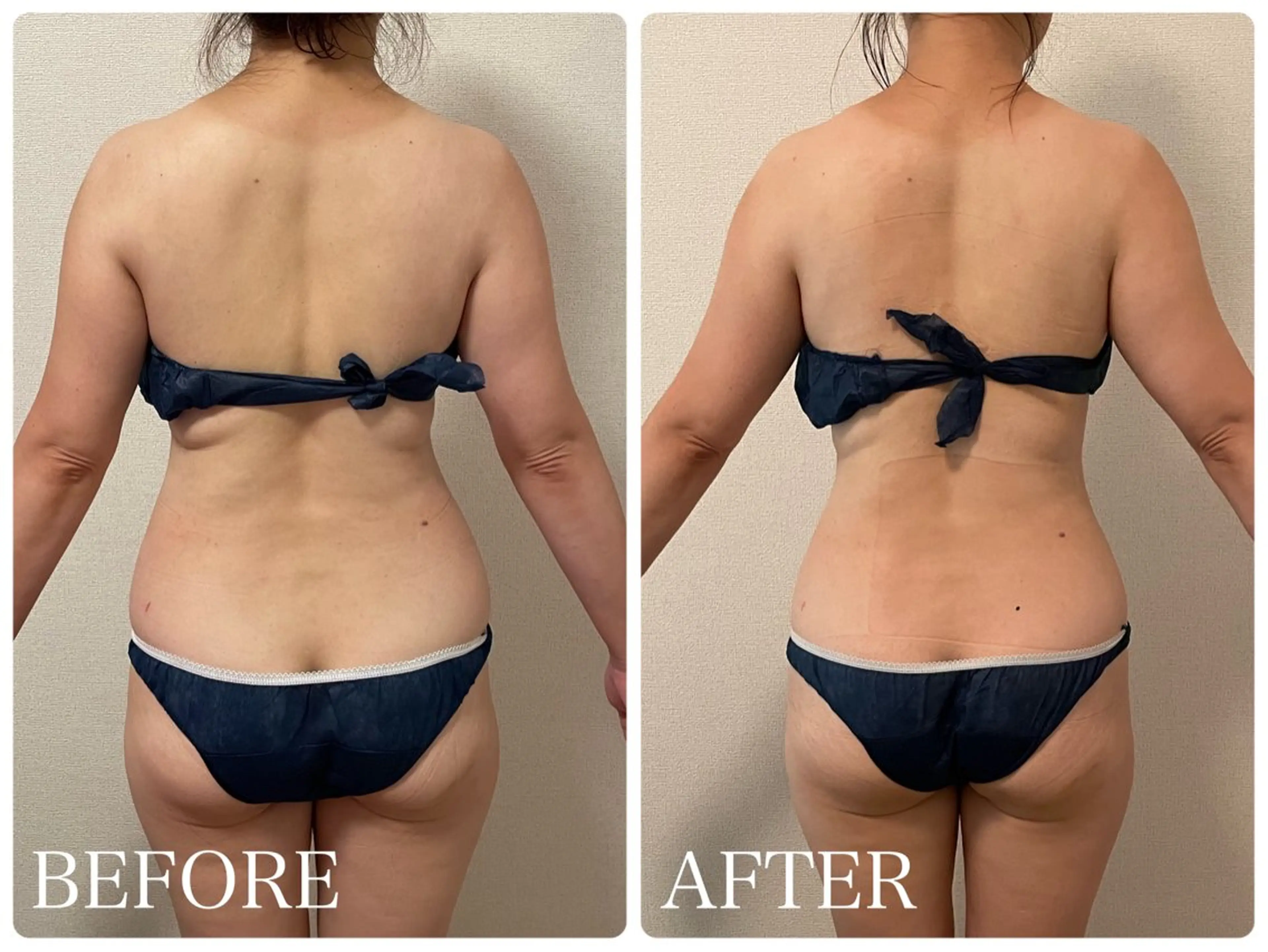 WINBACK＆オールハンド全身60分の写真