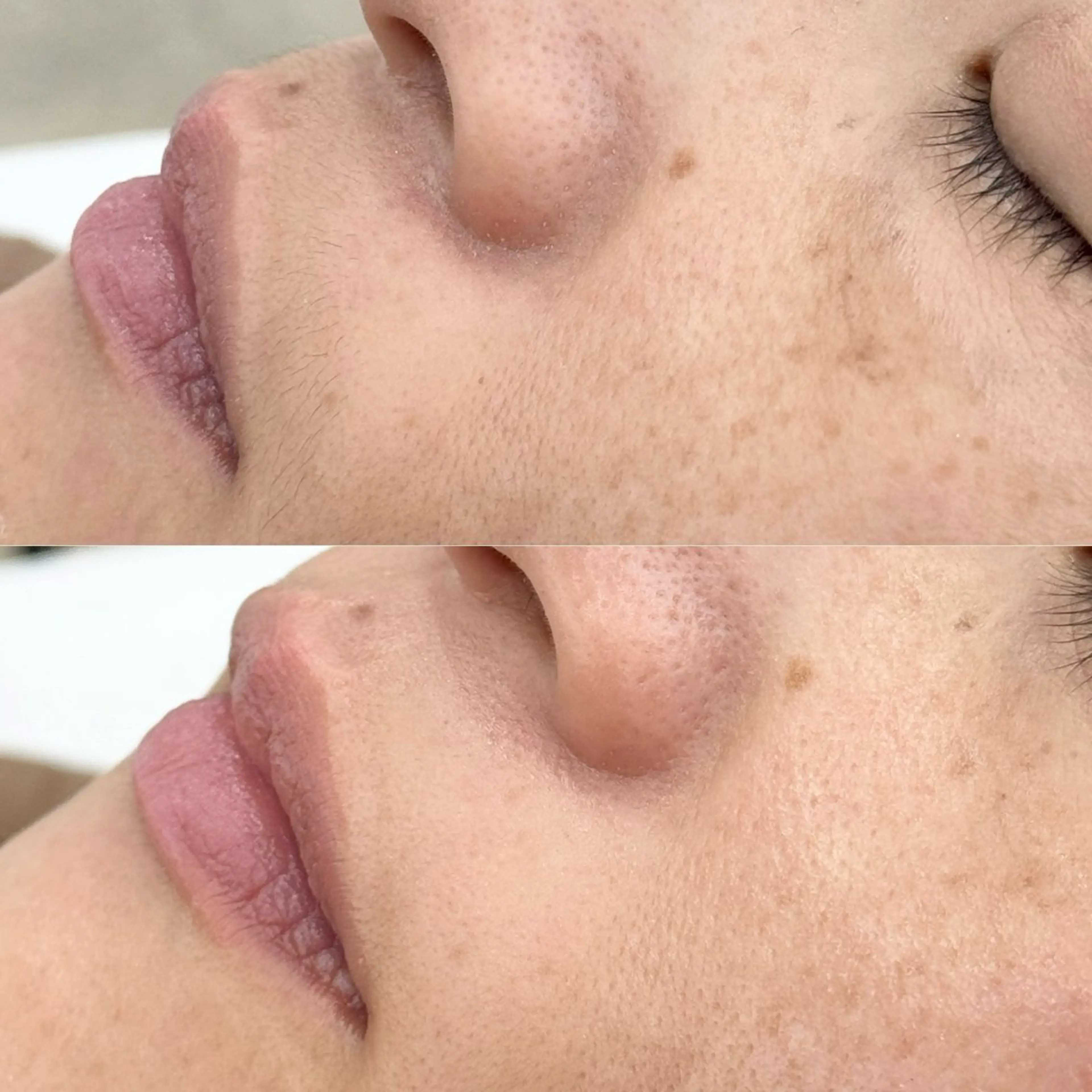 肌が綺麗になるフェイスワックスの写真