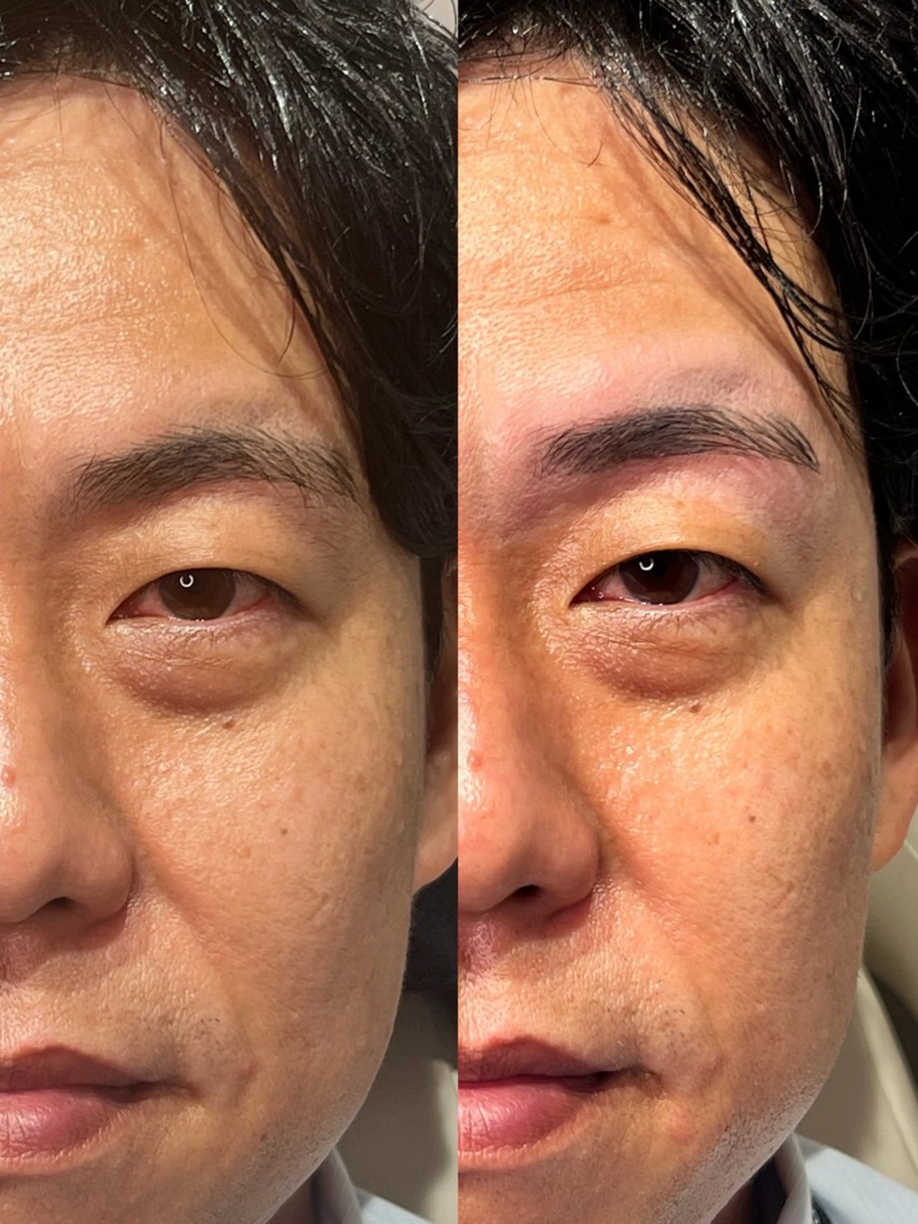 メンズ アイブロウ ワックス脱毛 眉カット 光岡 楓稀の眉毛・アイブロウイメージ