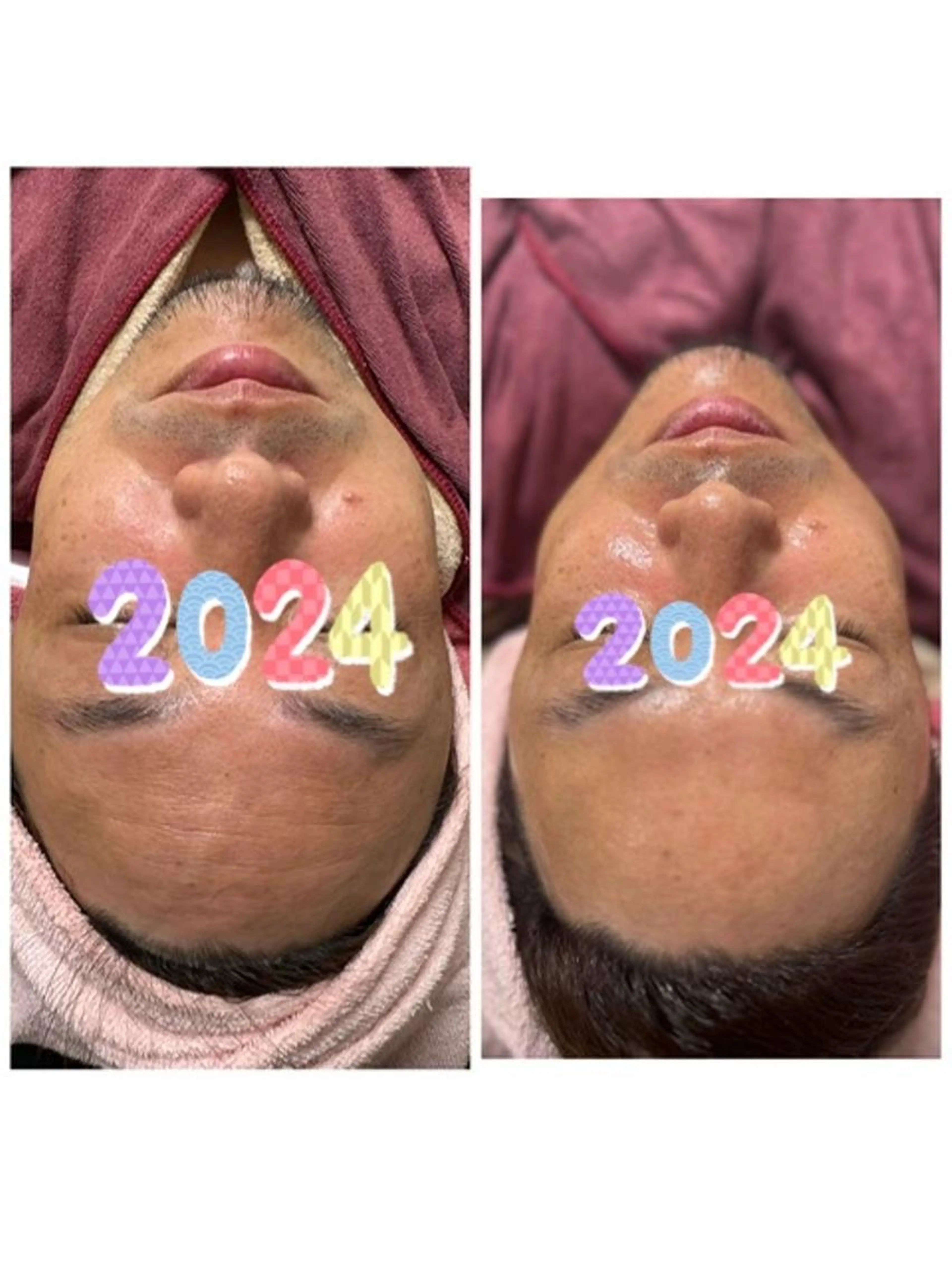 【メンズフェイシャル】　メンズもお肌きれいにしませんか？メンズ専用のフェイシャルエステ60分の写真