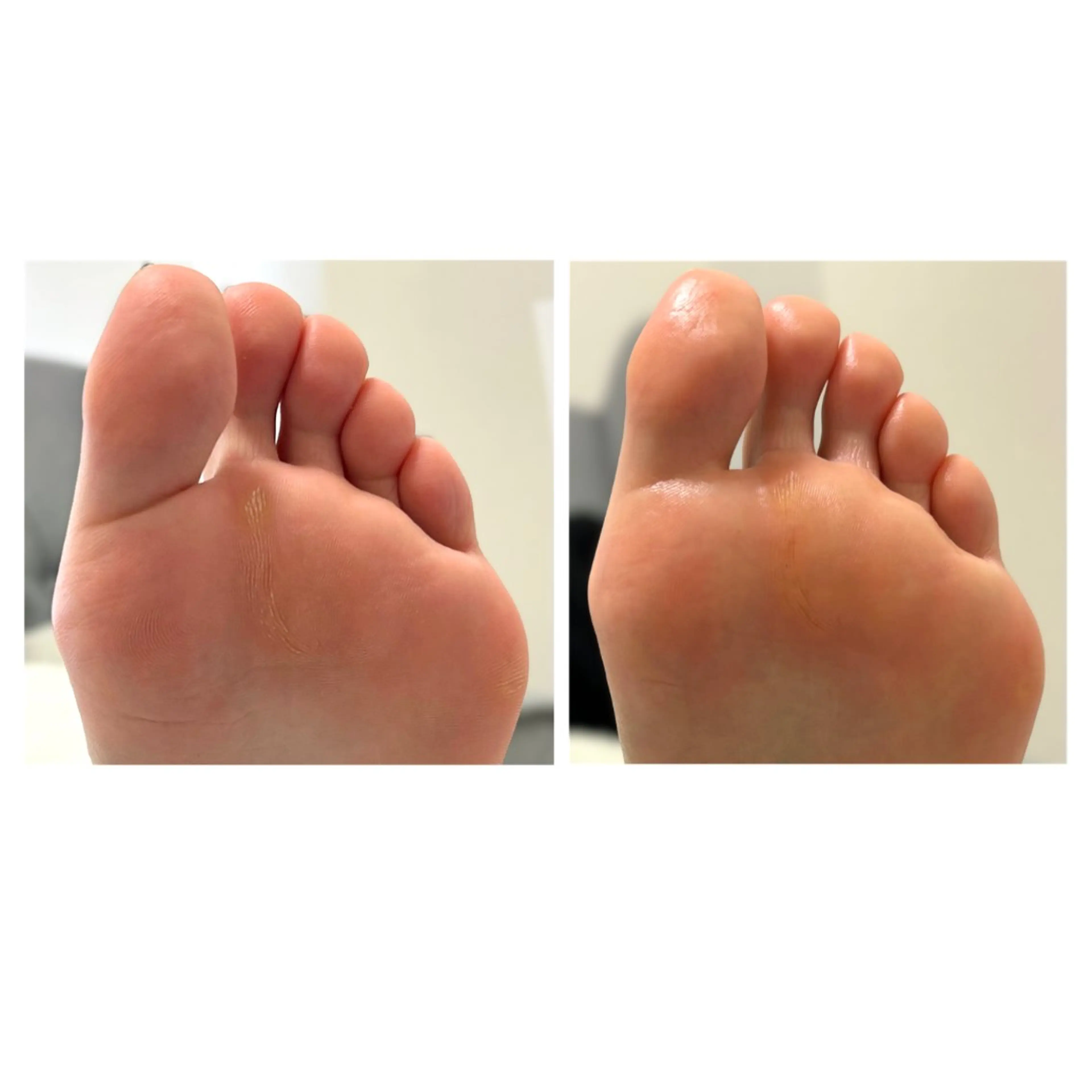 その他 なが さきのネイルデザイン