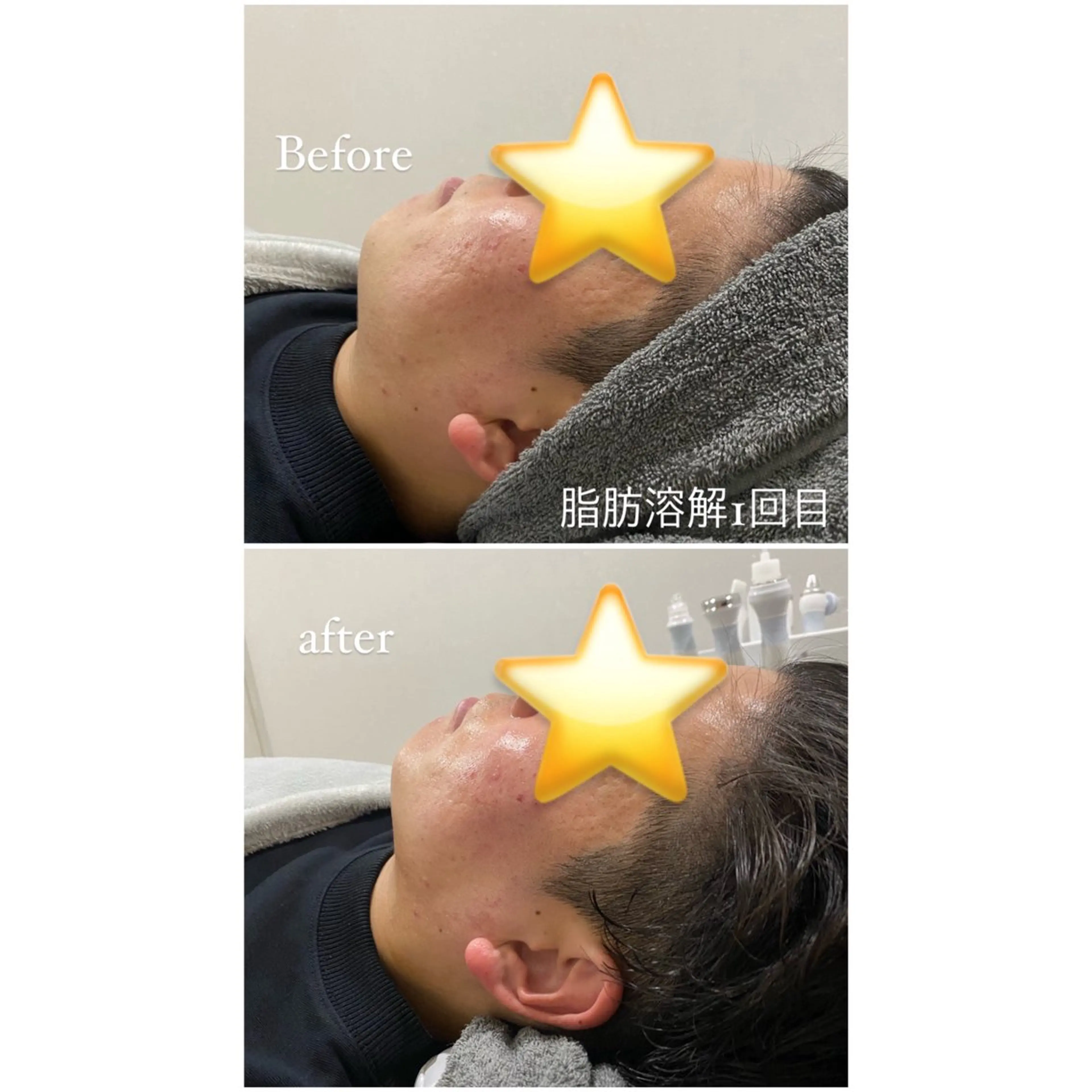 エステ 毛穴洗浄・痩身・脱毛 /アルカンジュのエステ・リラクイメージ