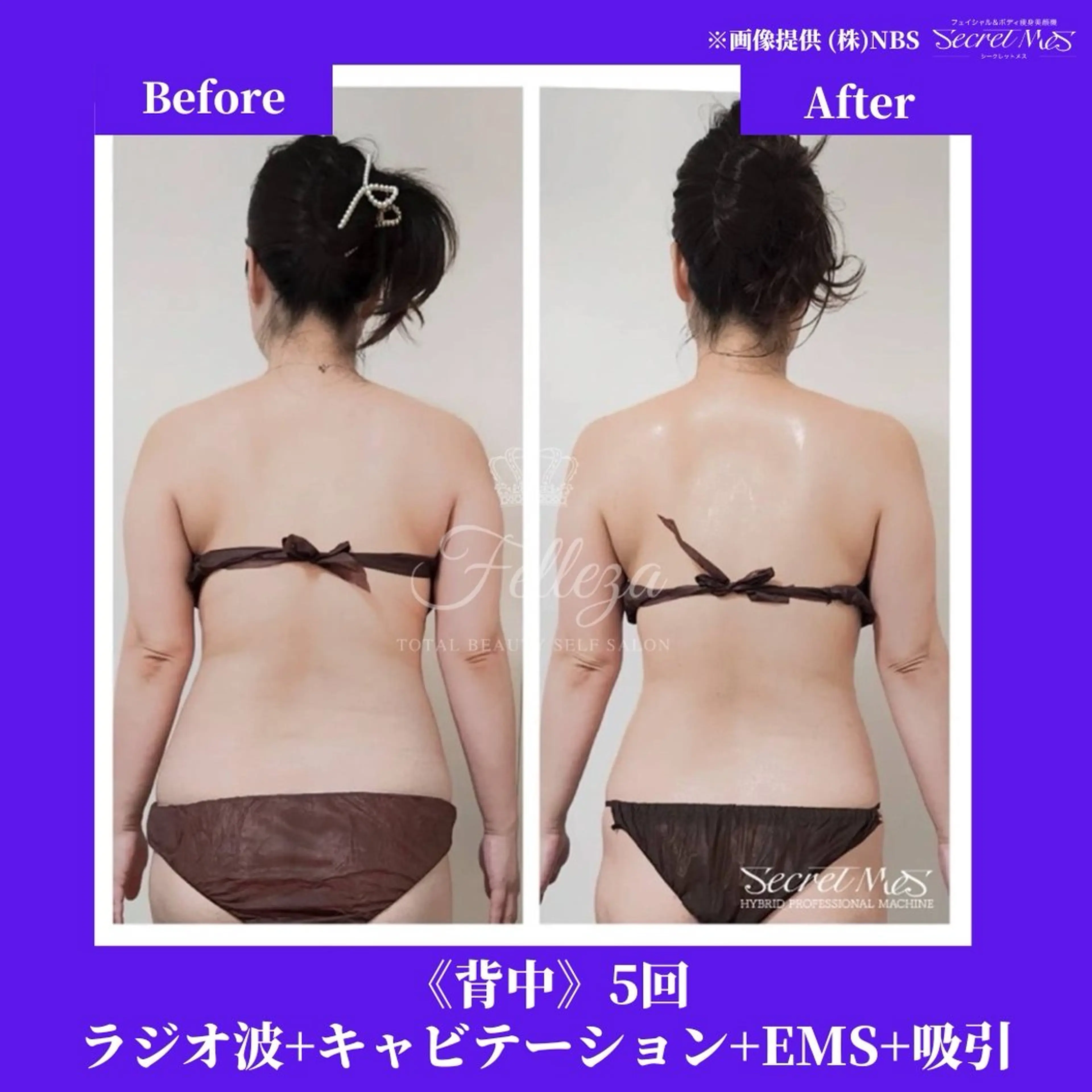 メンズ 有人型セルフサロン 脱毛／痩身／美顔のその他イメージ