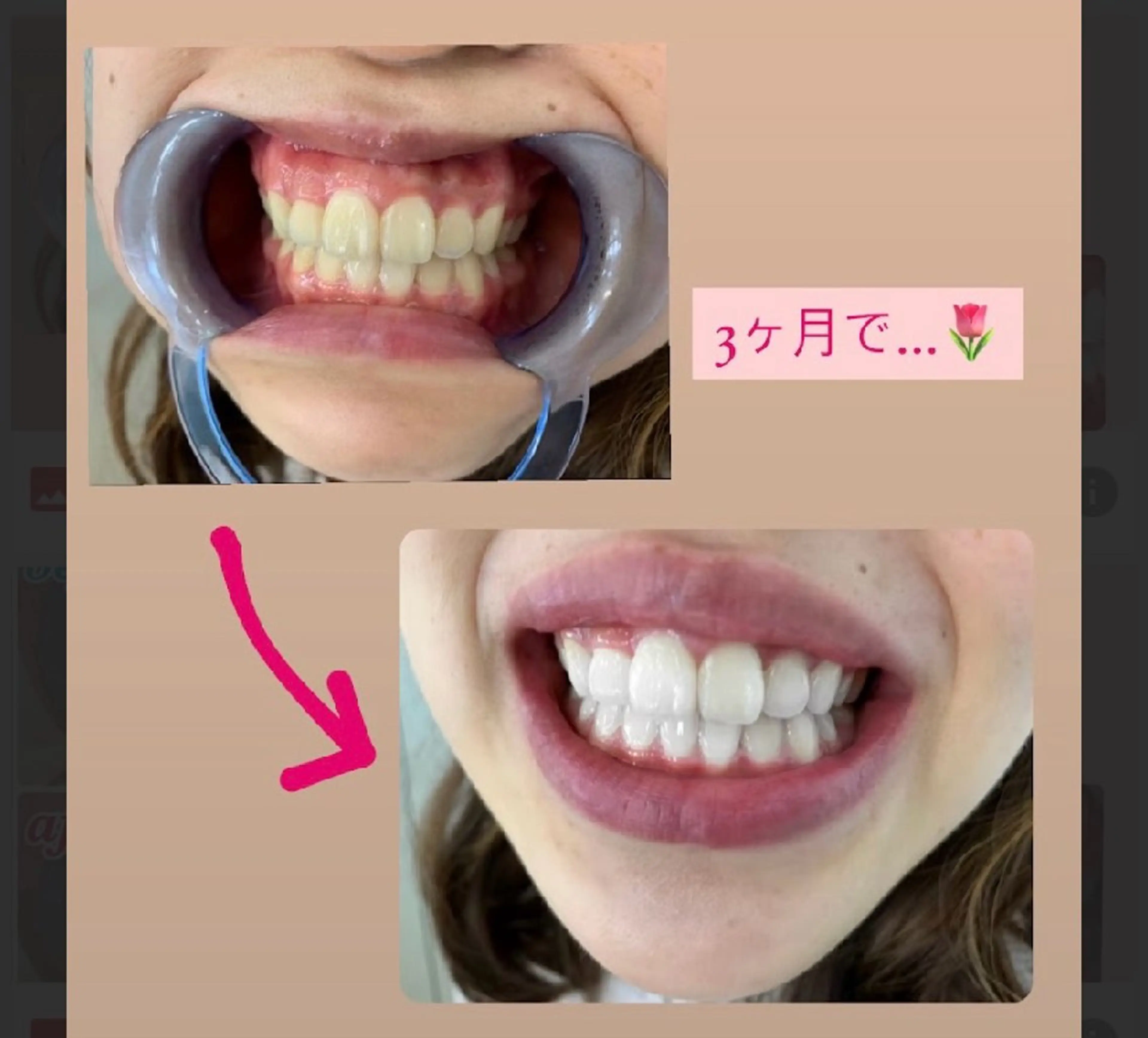 ecxia white 高田馬場所属・セルフホワイトニング エクシア 高田馬場のその他イメージ