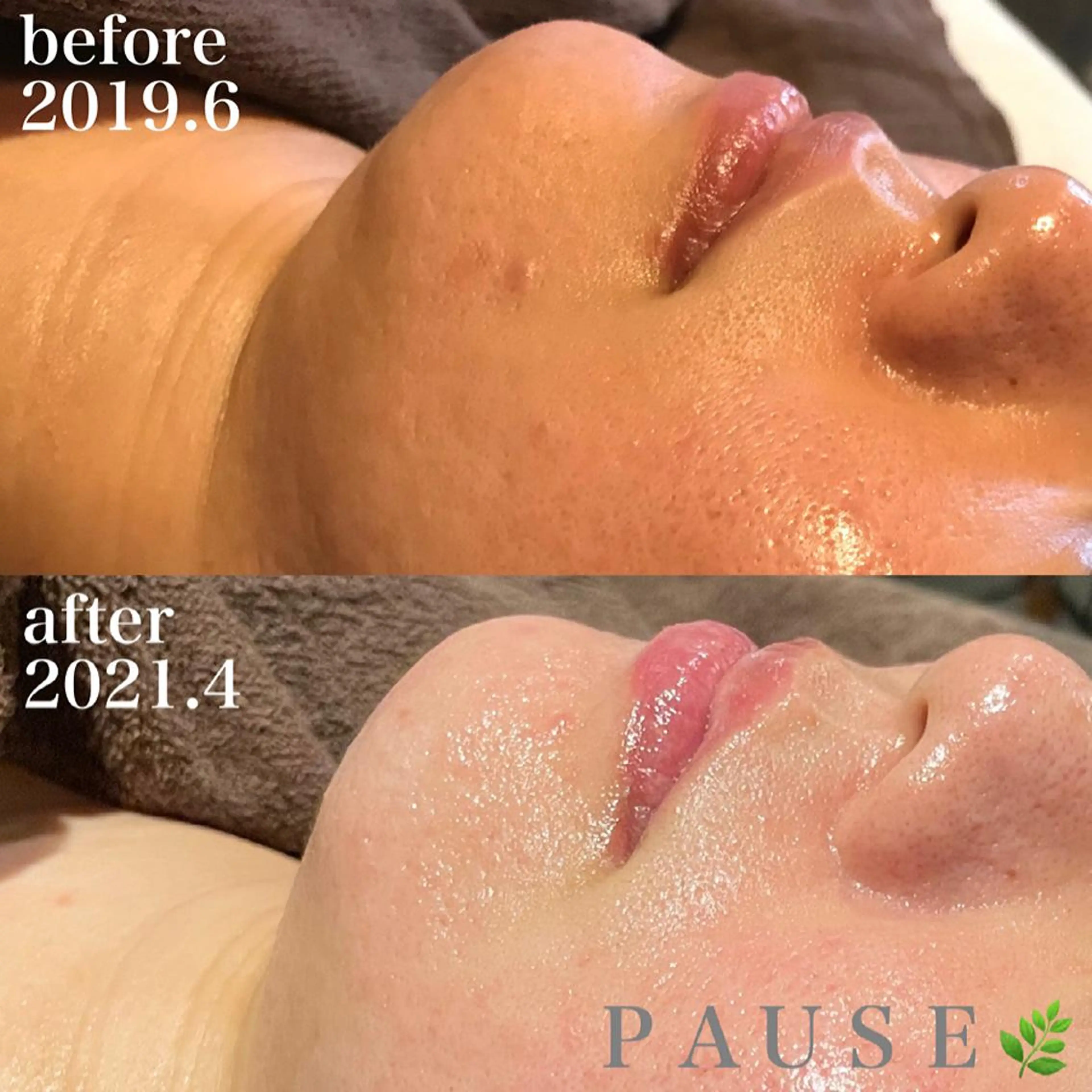 エステ 浜野 恵美のエステ・リラクイメージ