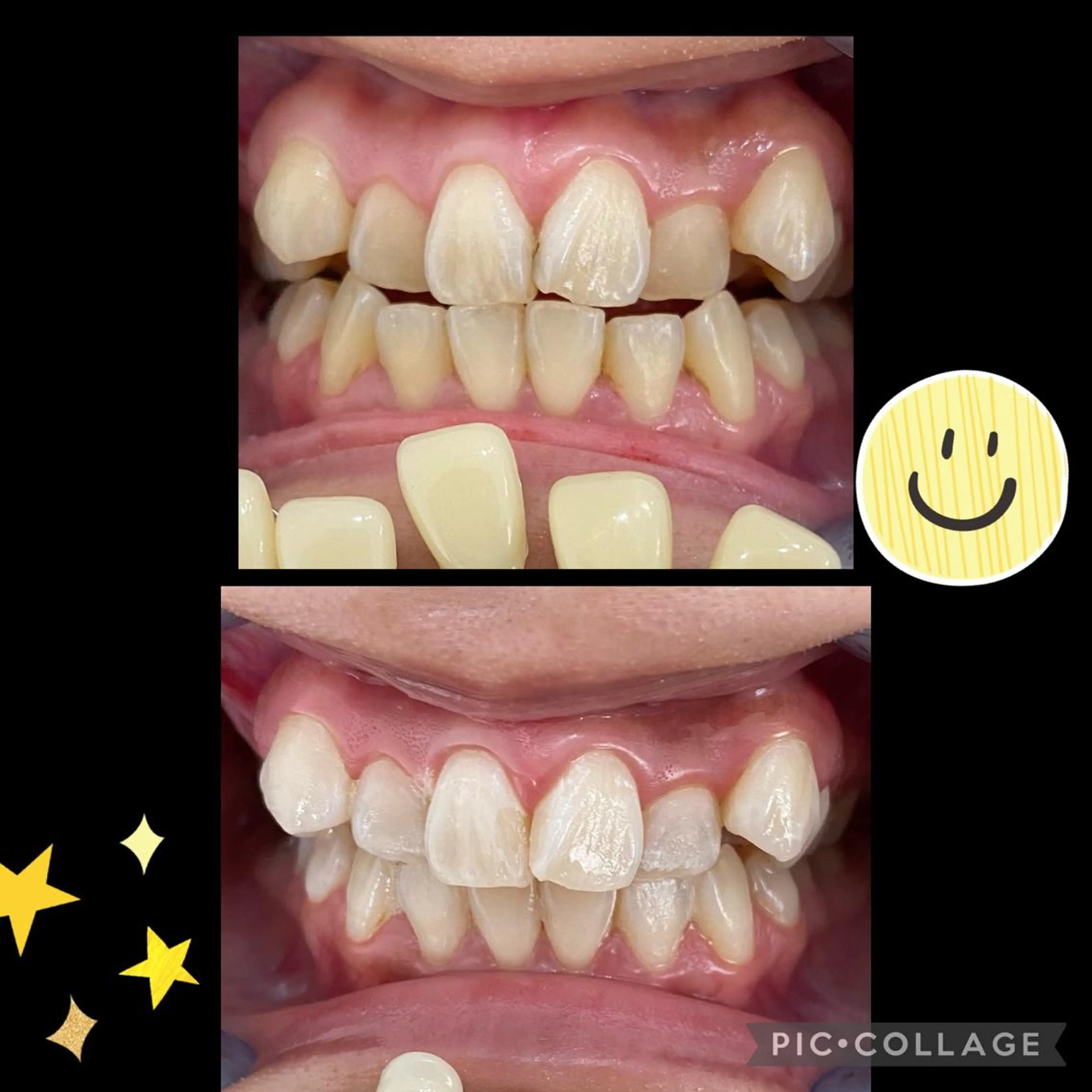 【新価格】初回スタンダードコース 9分光を3セットの写真