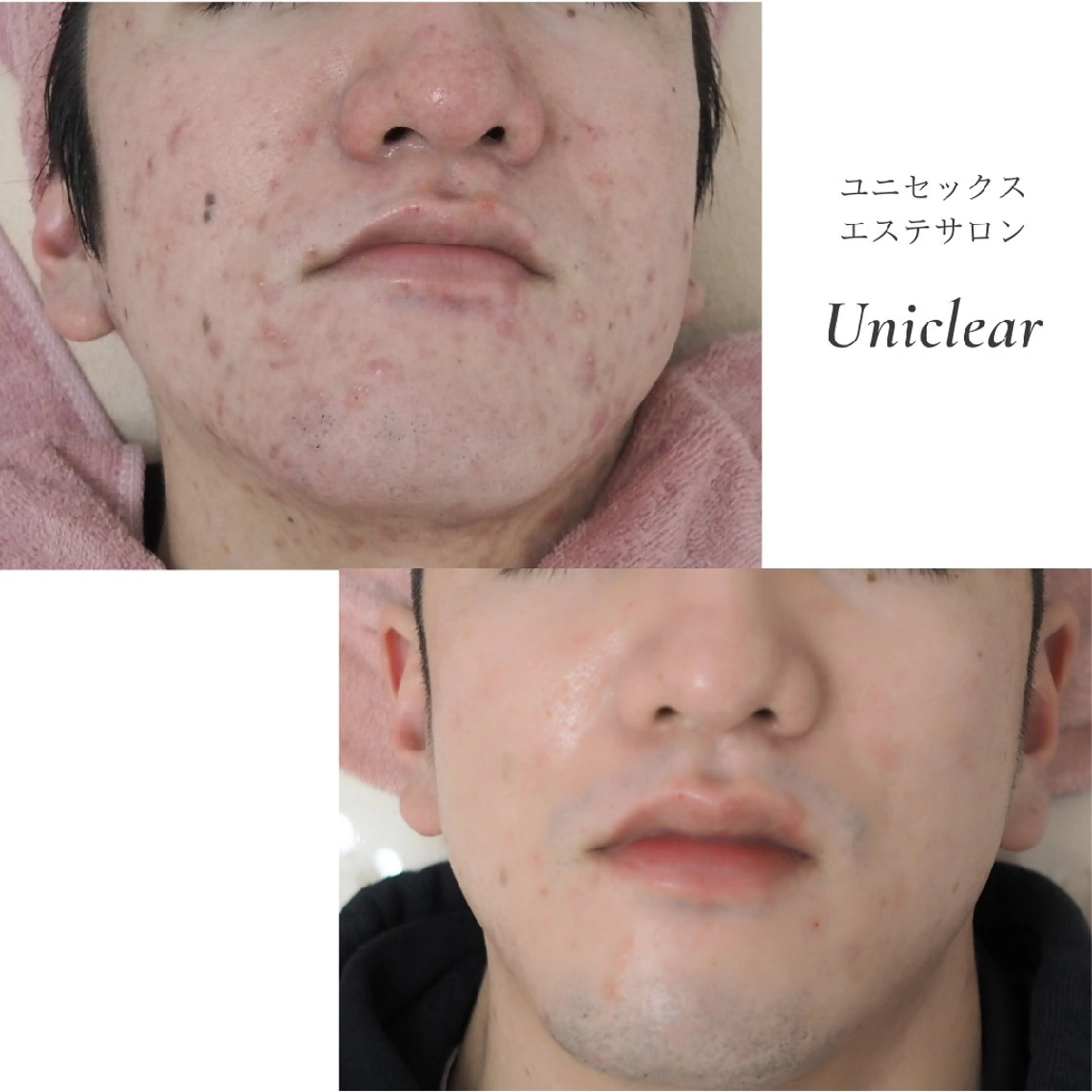 メンズ ユニセックスエステサロンUniclear所属・痩身&フェイシャル Uniclearのエステ・リラクイメージ