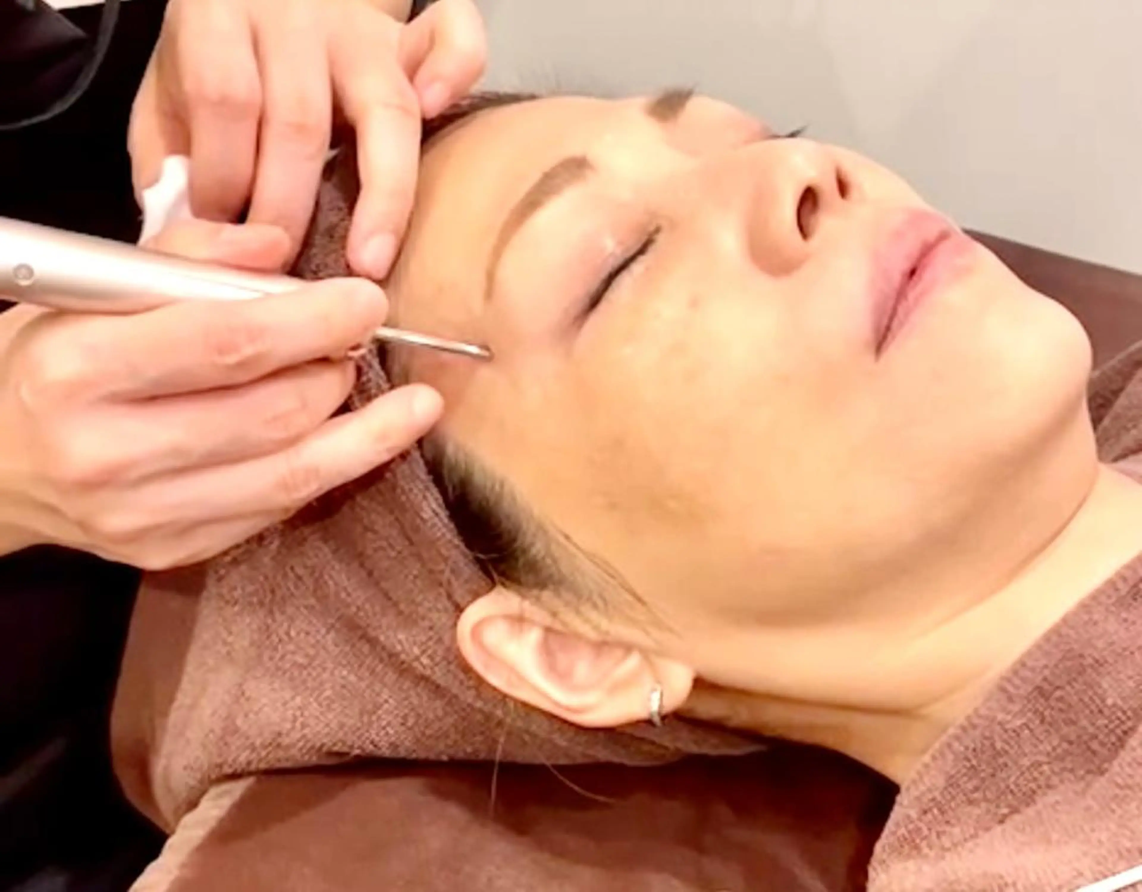 《初回お試》しみケアフェイシャルの写真