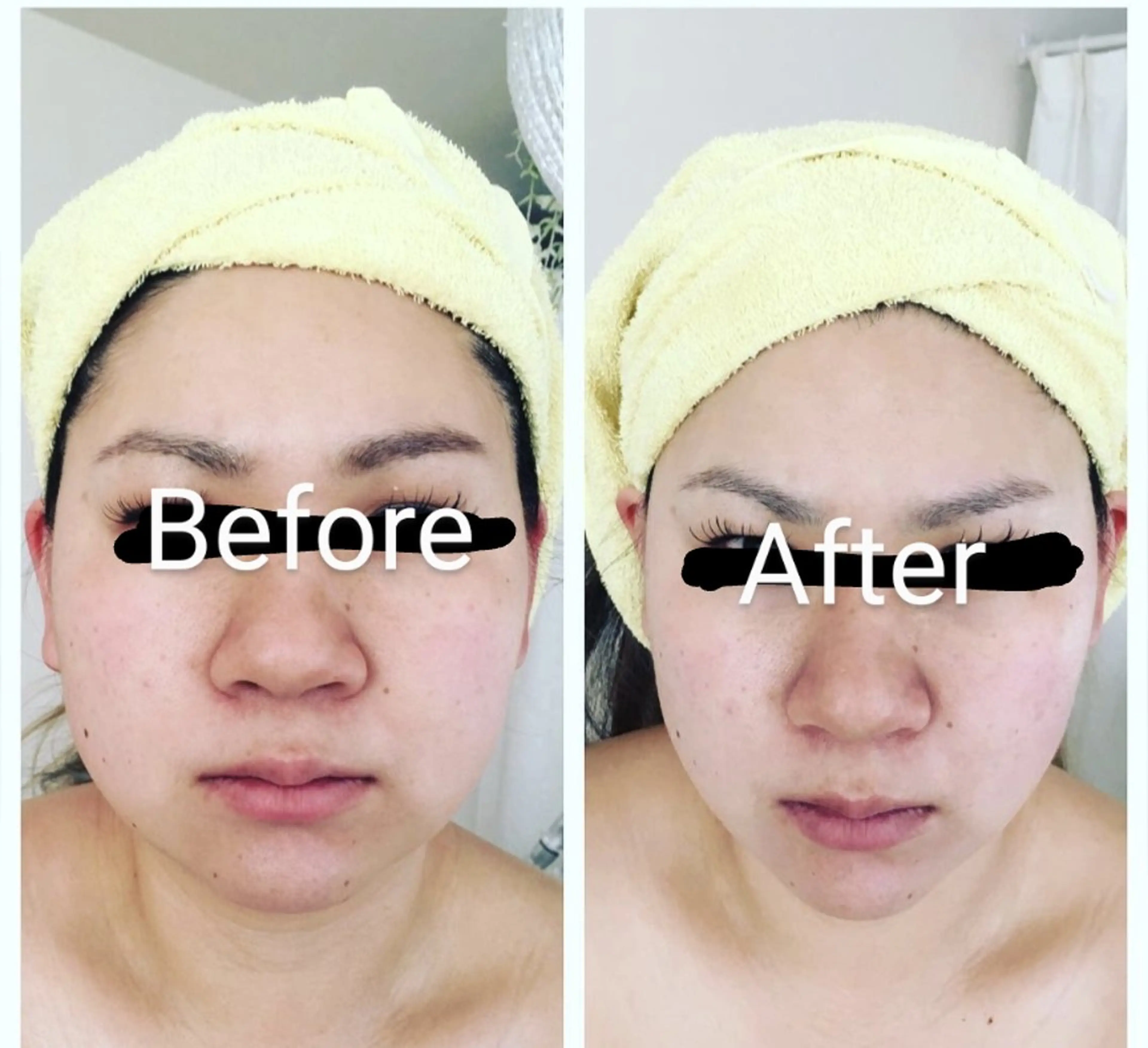 エステ リラク ヤマダ アキナのエステ・リラクイメージ