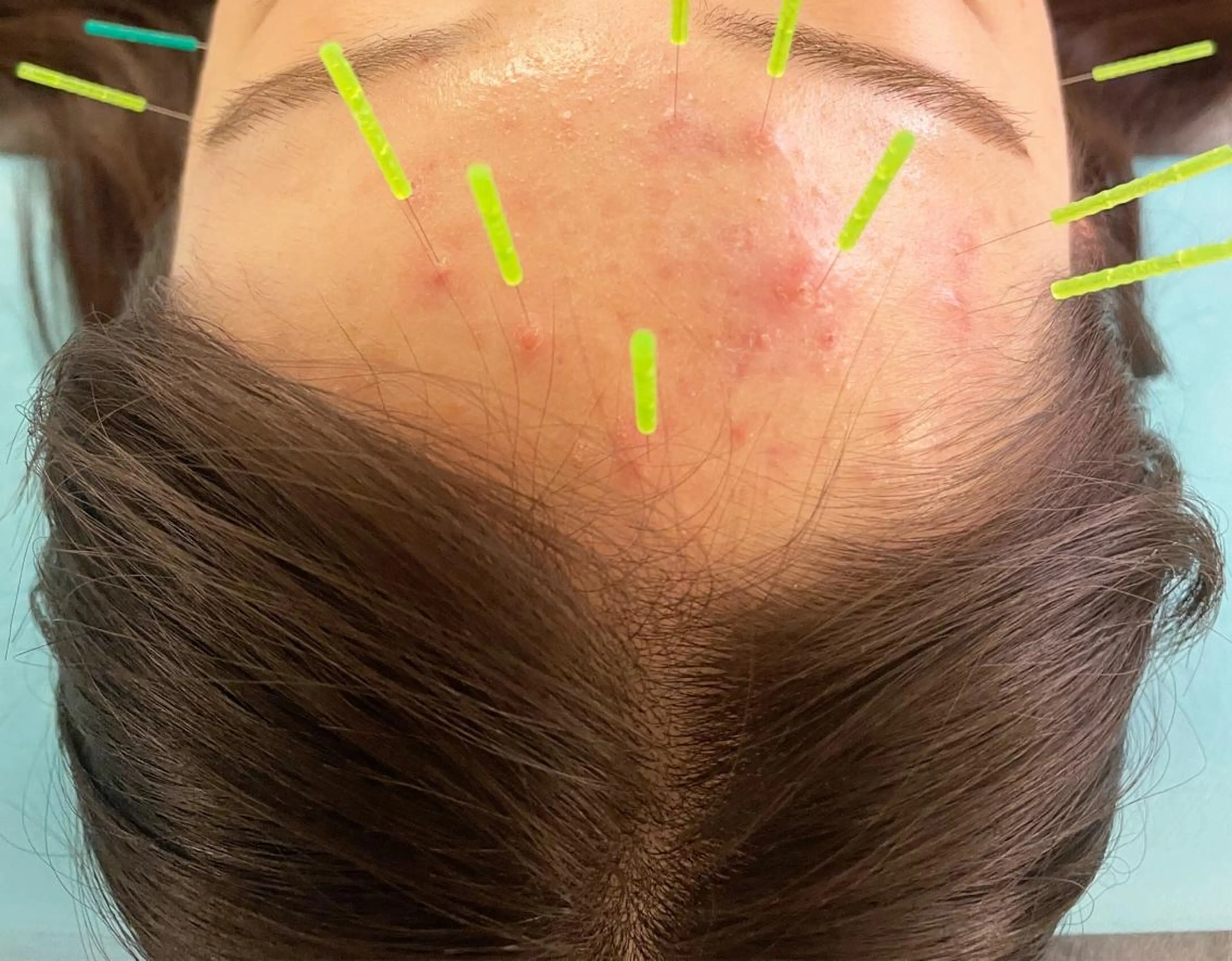 エステ リラク 小顔美容鍼専門サロン 渋谷YZのその他イメージ