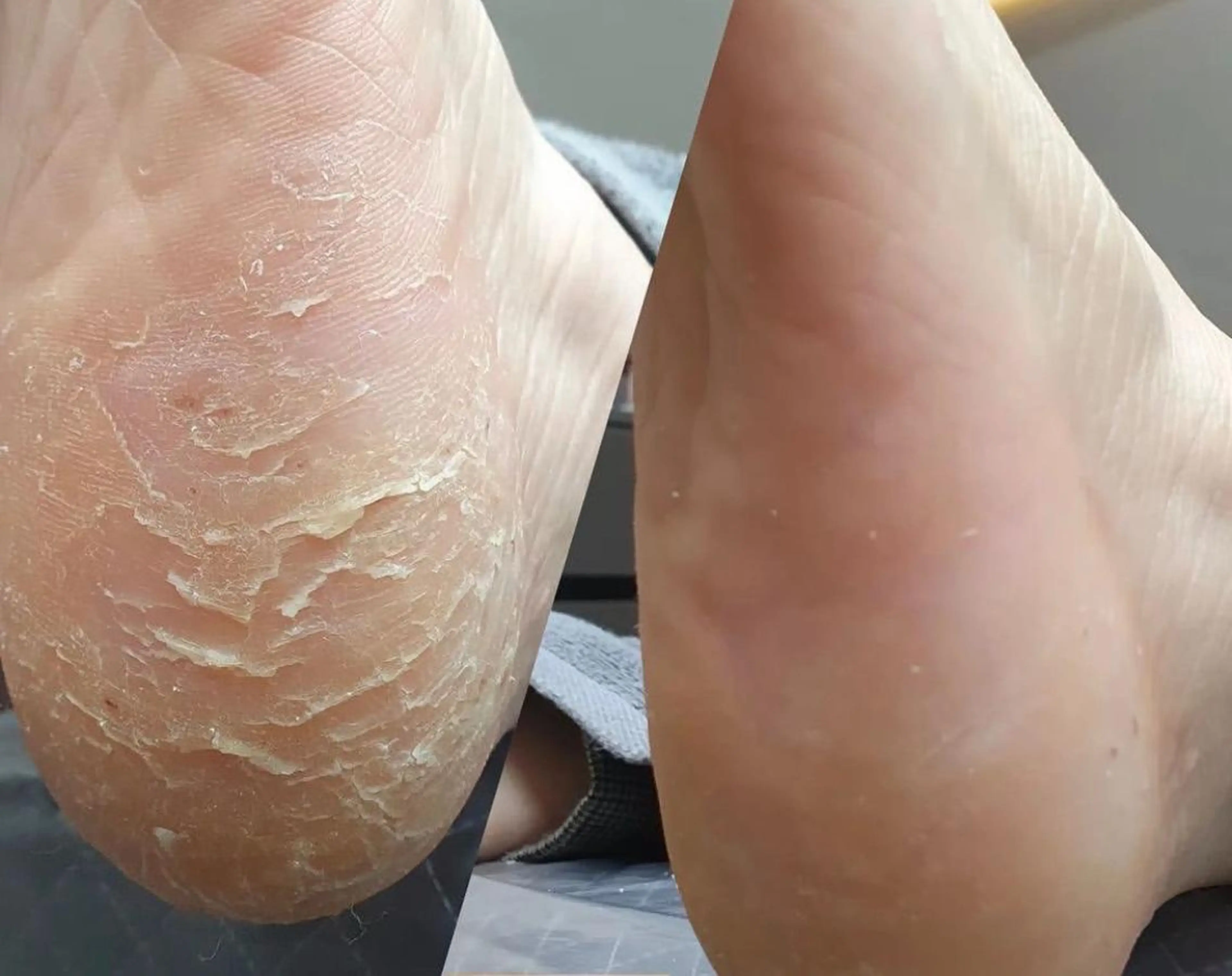 その他 Eye   Beauty所属・松田 由紀のマツエク・マツパデザイン