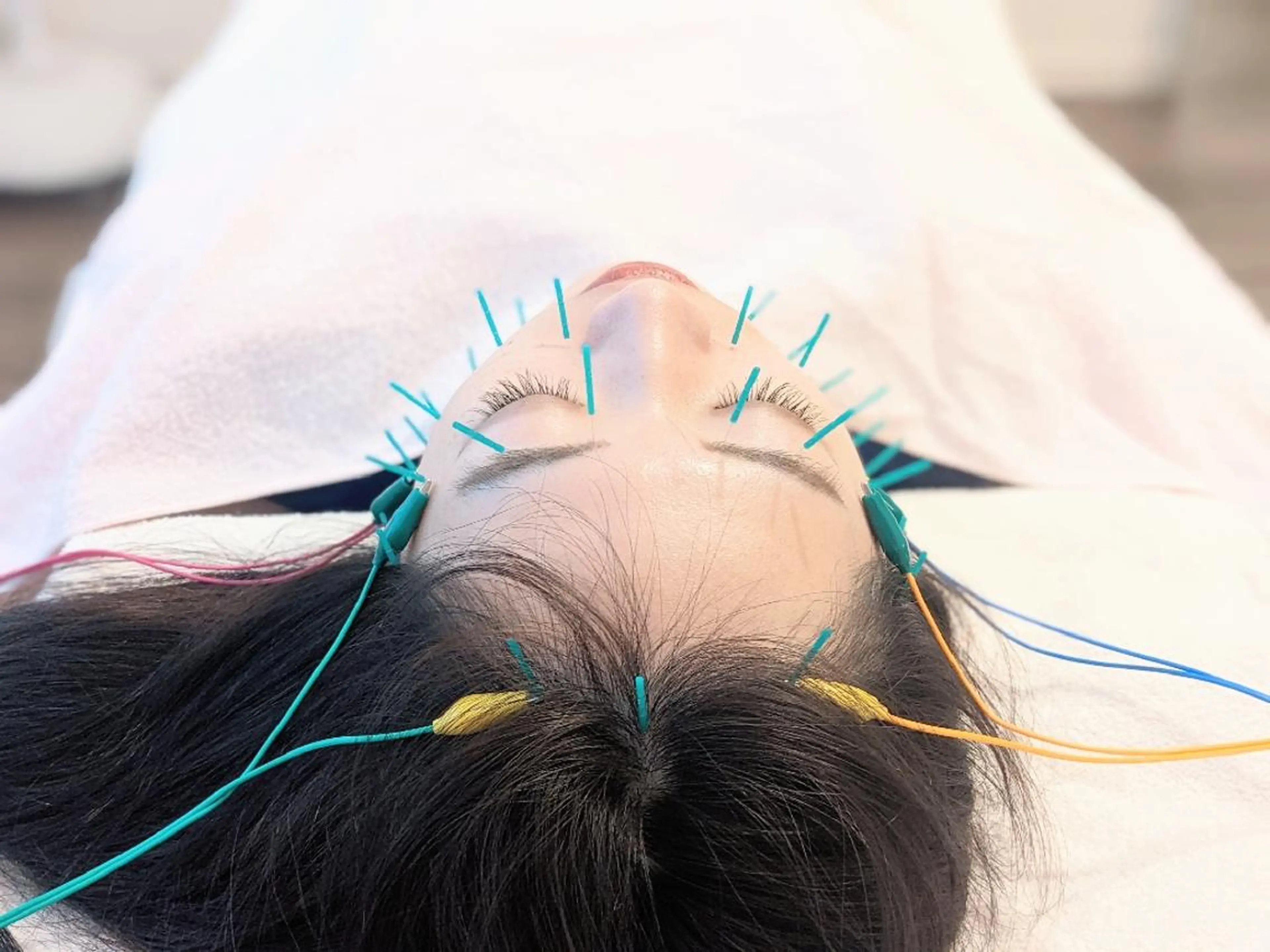 小顔美容鍼灸Acubelle Yakuin.【アキュベル薬院】所属・石川 真梨奈  美容鍼灸/アロマのエステ・リラクイメージ