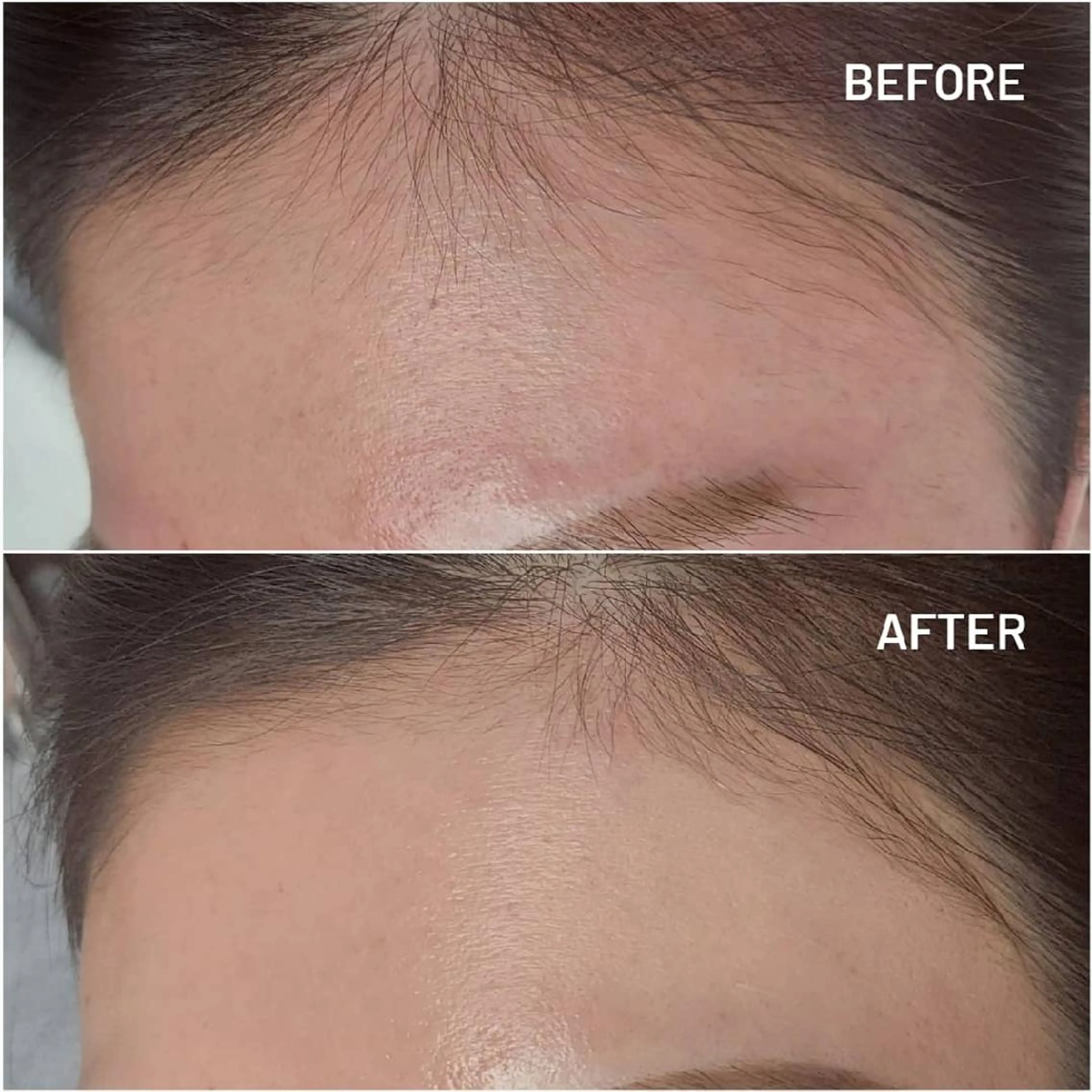 アイブロウ 眉毛ワックス脱毛 ワックス脱毛 眉カット その他(アイブロウ) U_la所属・U_la [ウーラ] 片岡の眉毛・アイブロウイメージ