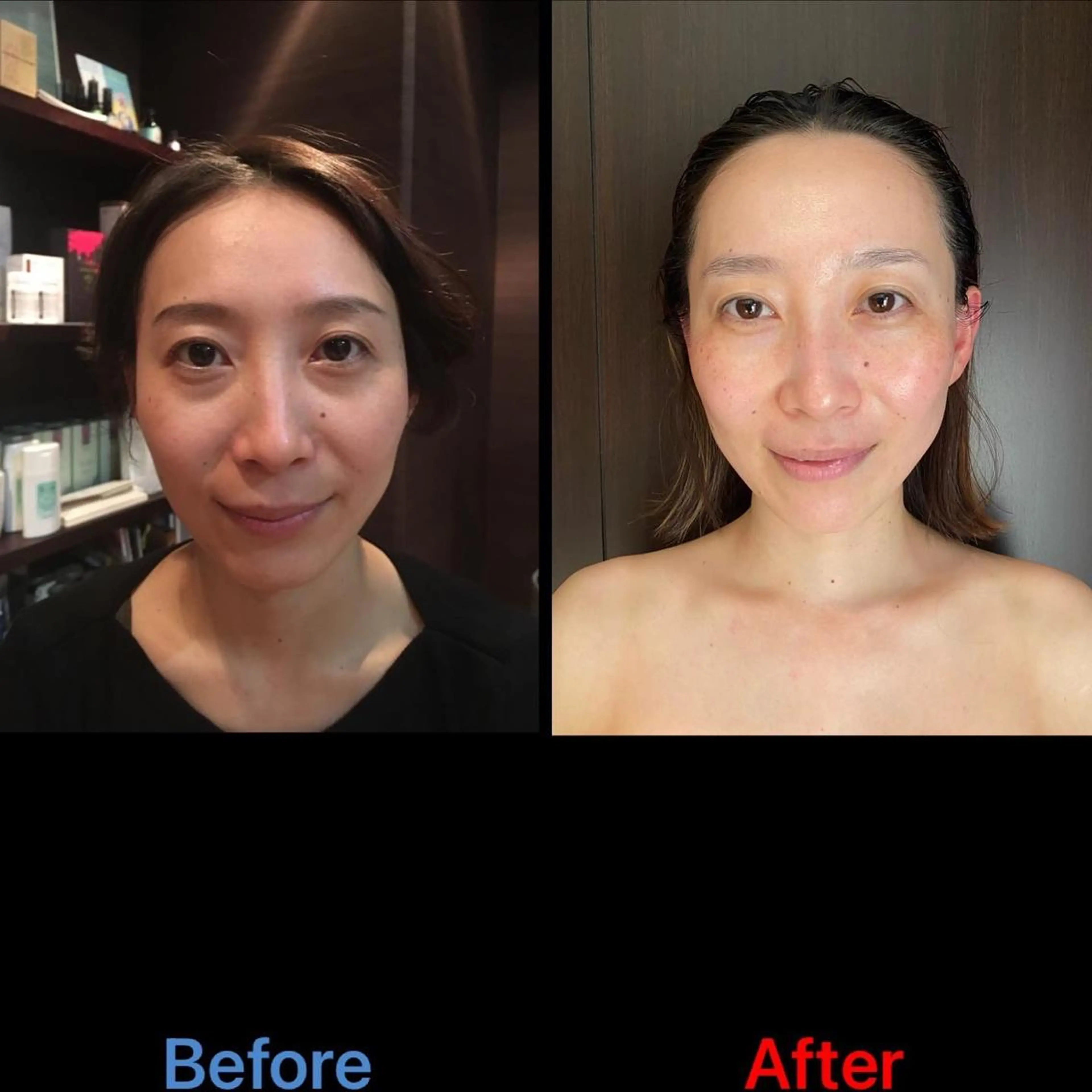 WINBACK salon　un agio所属・サロンドアンアージョ un agioのエステ・リラクイメージ