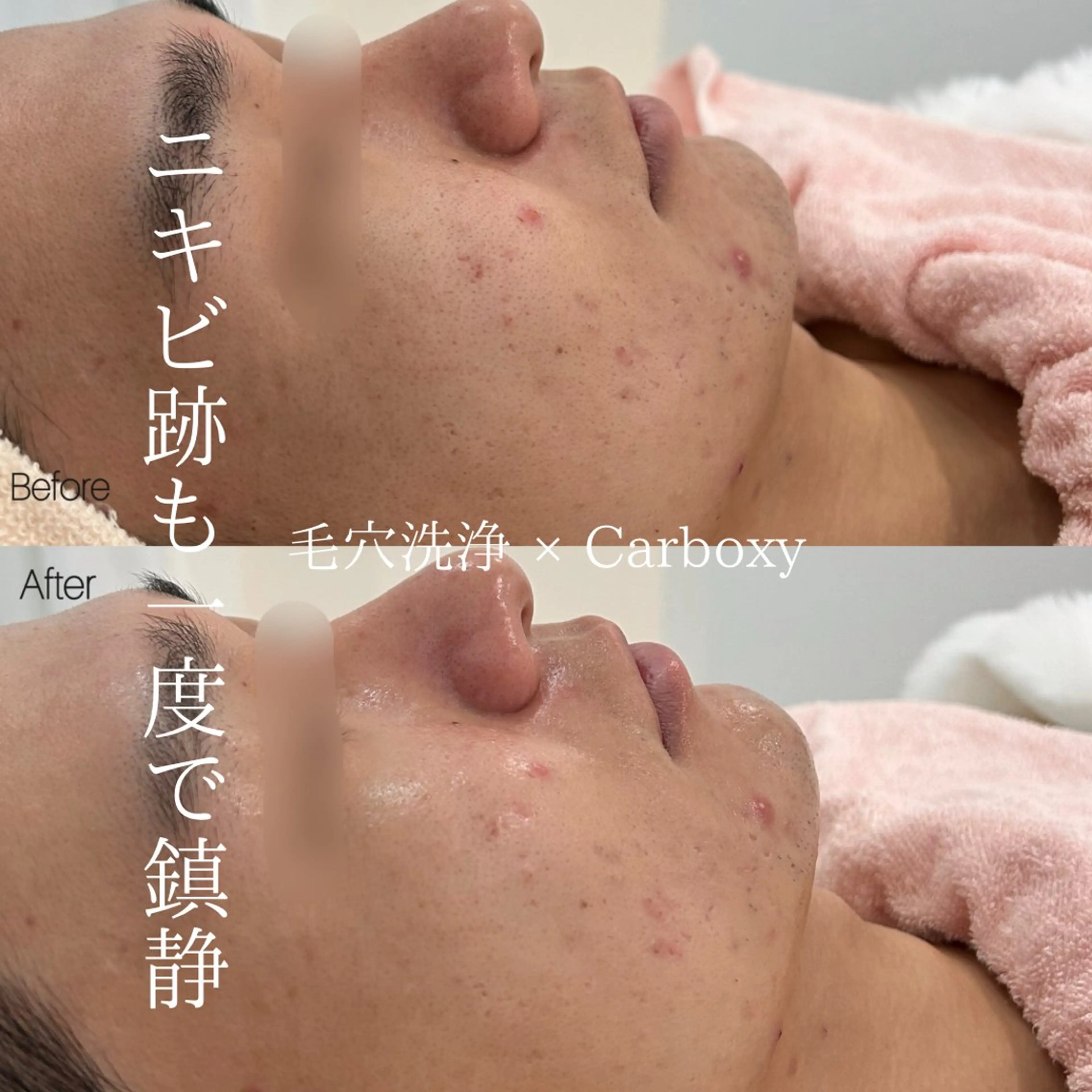 メンズ エステ 〈etre〉トータルビューティーサロン所属・etre - 韓国肌管理 -のエステ・リラクイメージ