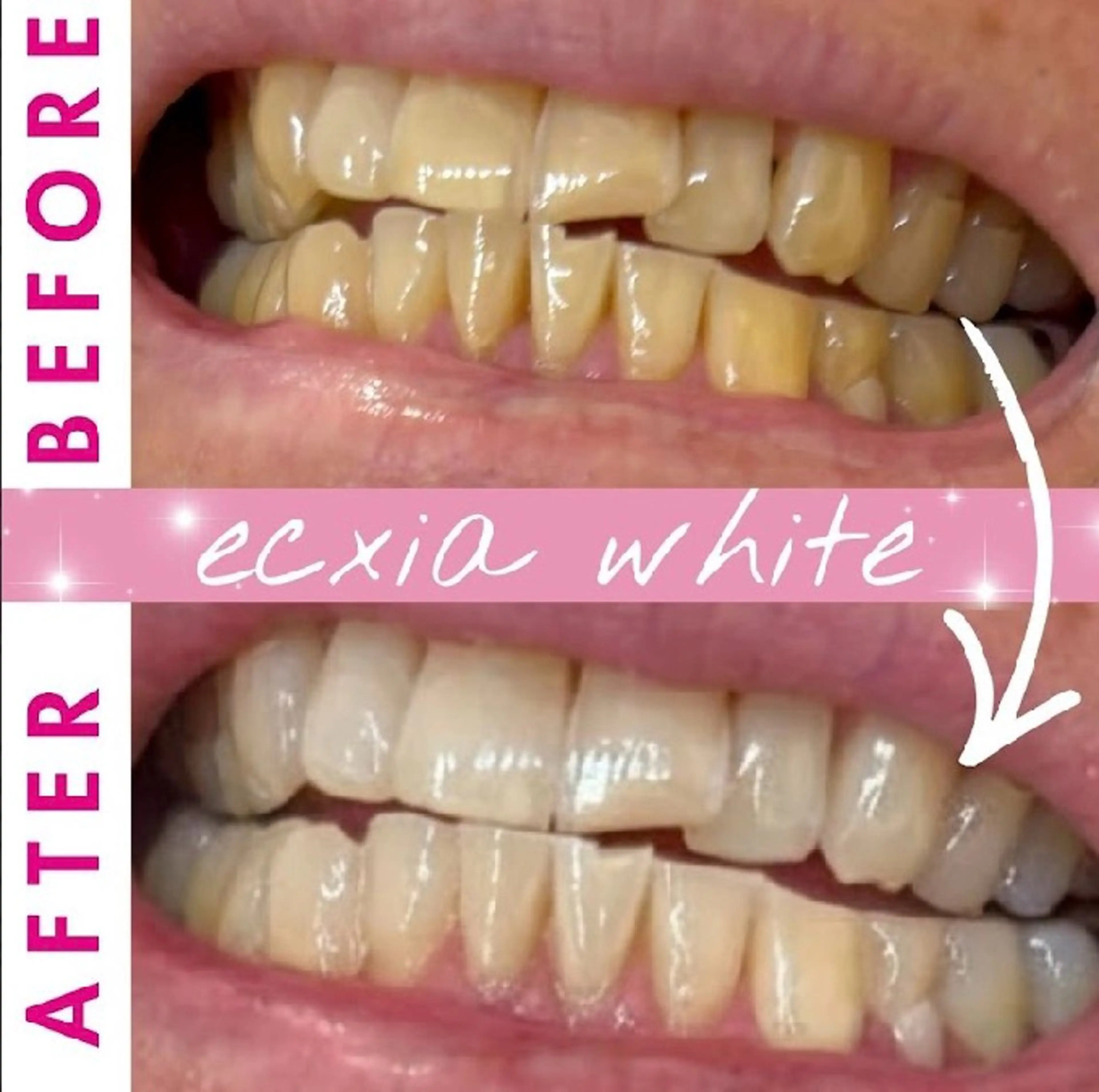 セルフホワイトニングサロンエクシアホワイト倉敷店所属・ecxiawhite 倉敷店のエステ・リラクイメージ