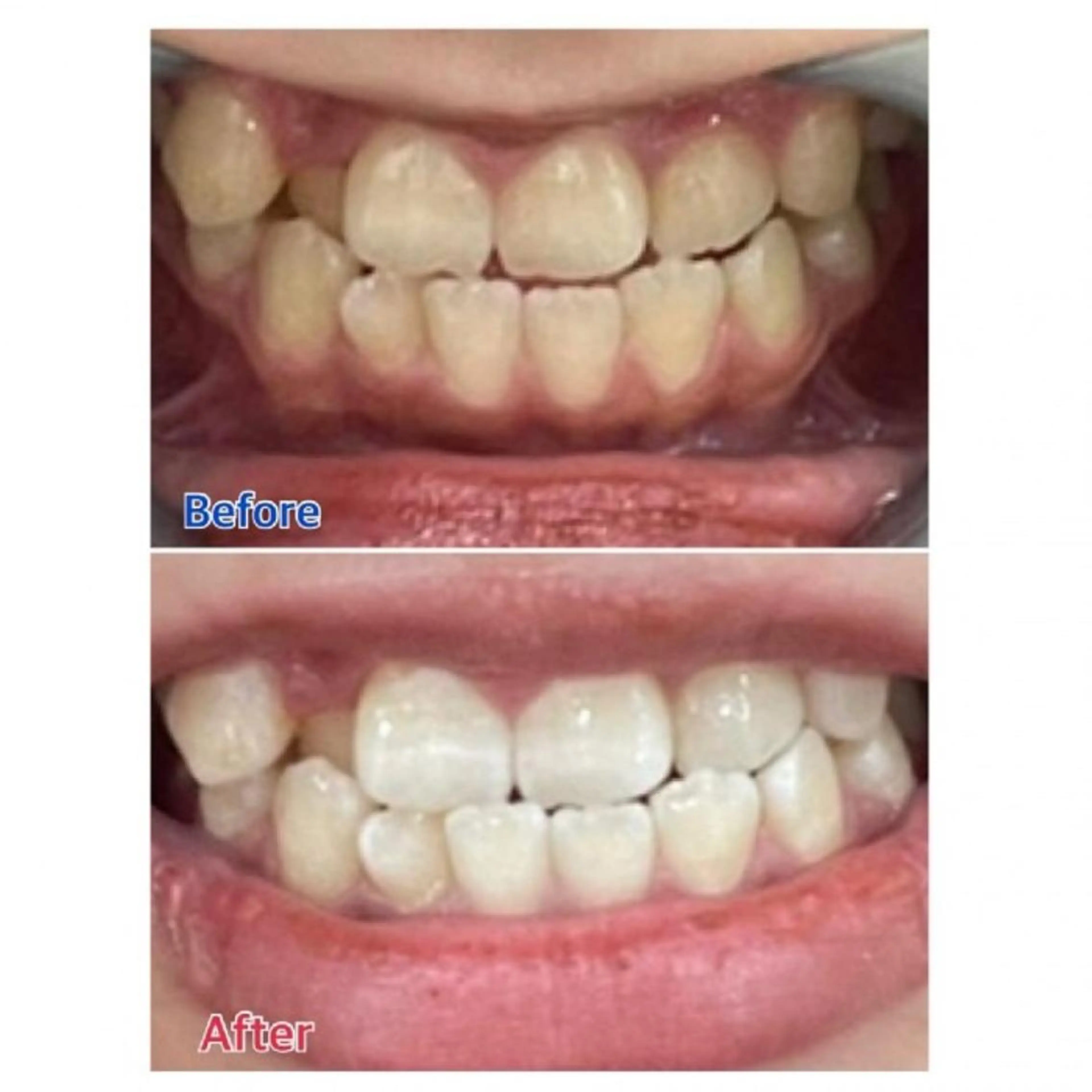 M渋谷店所属・M渋谷 ホワイトニングのエステ・リラクイメージ