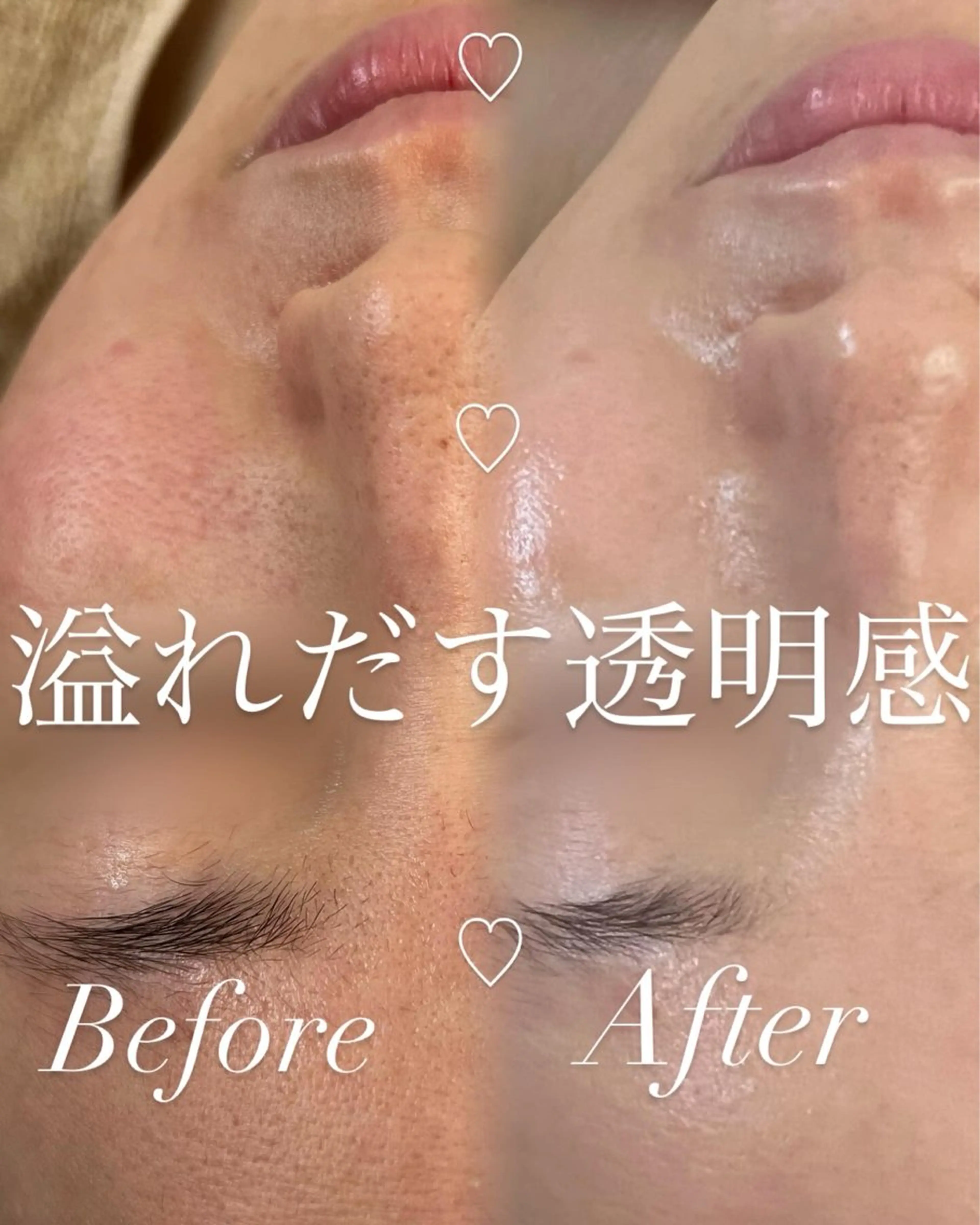 ｍｉkｉ 東根の肌質改善サロンのエステ・リラクイメージ