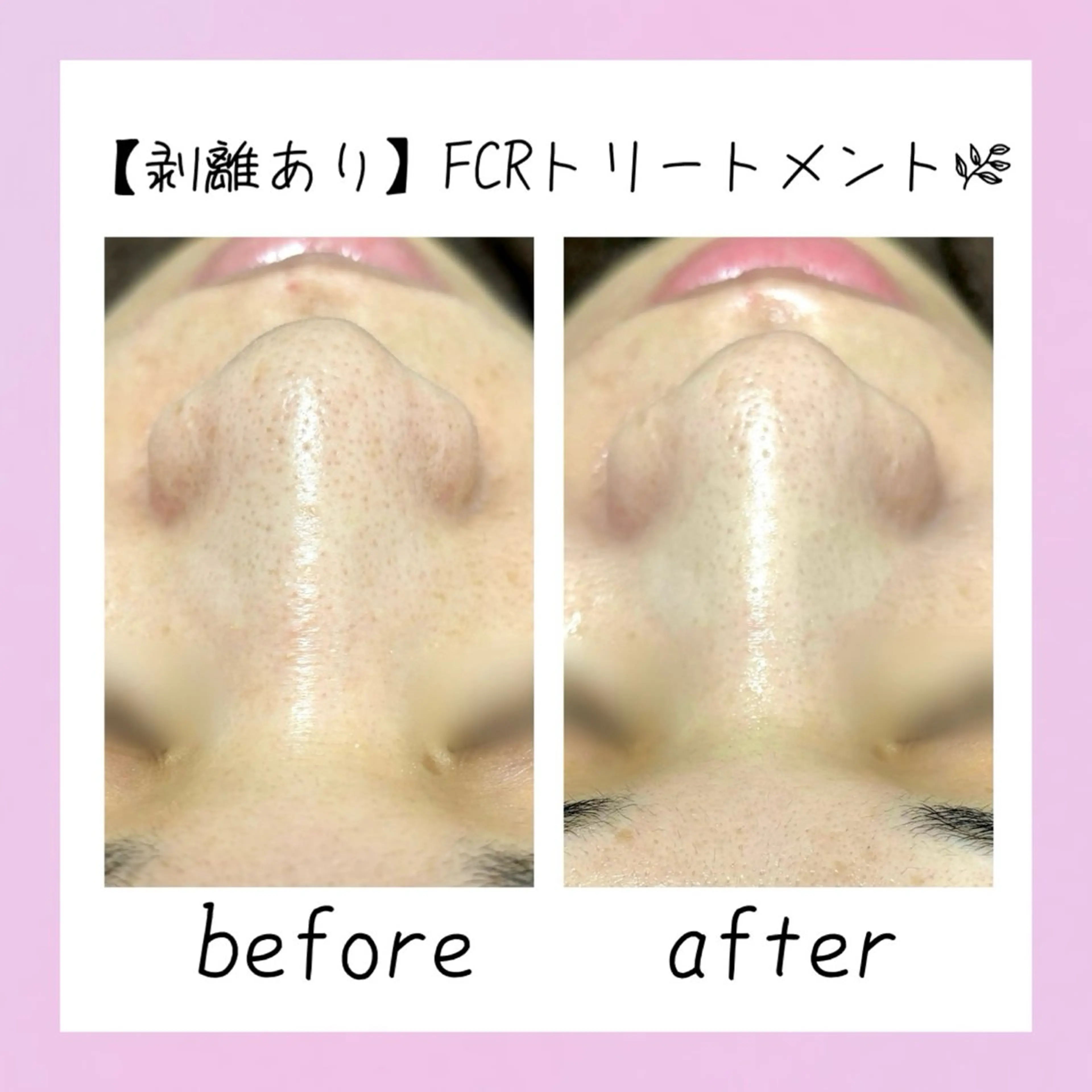 肌質改善Charme coco 増毛のエステ・リラクイメージ