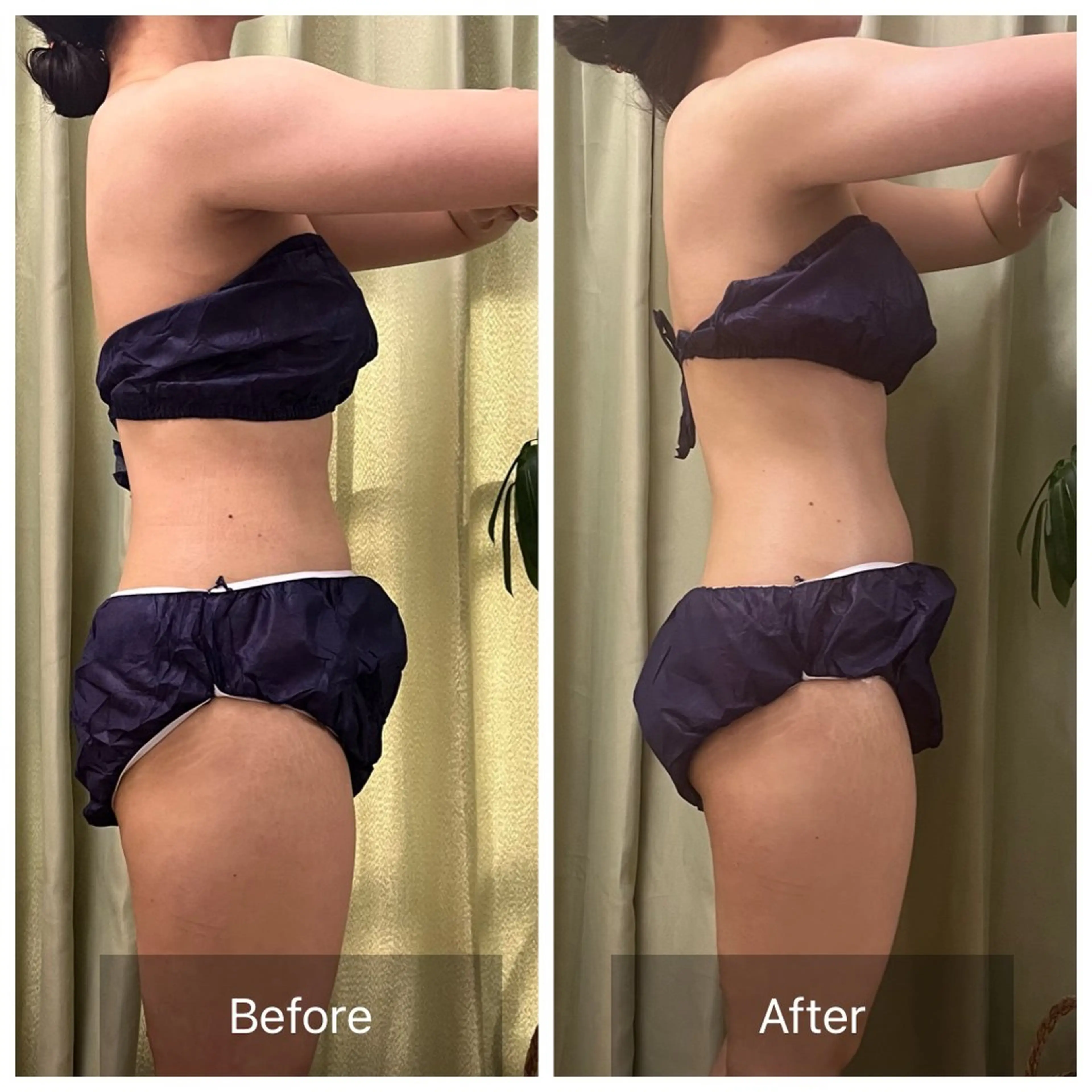 エステ リラク 【元に戻らない】 小顔&部分痩せのその他イメージ