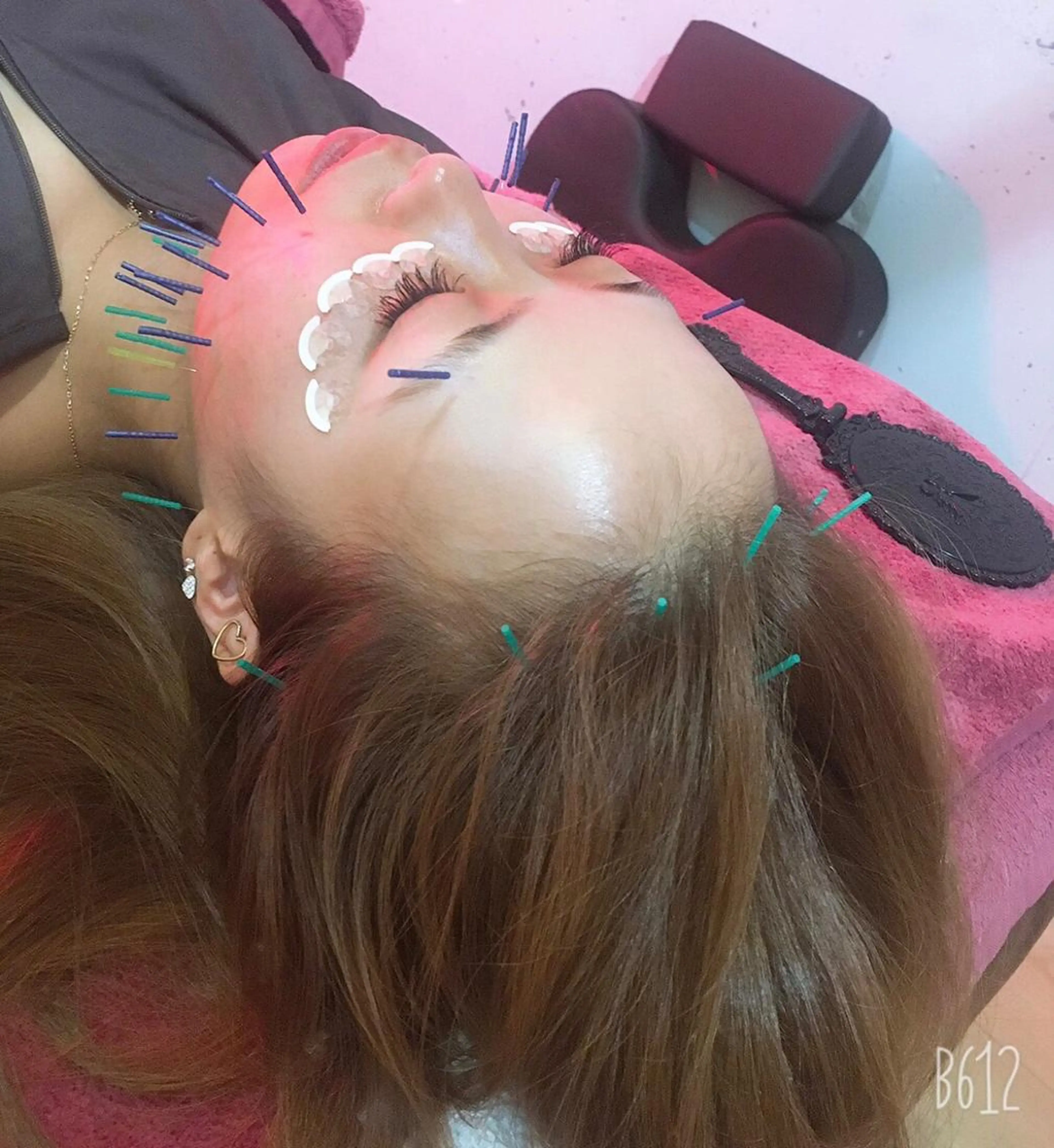 美容鍼灸女性専用 りんご鍼灸治療院のエステ・リラクイメージ