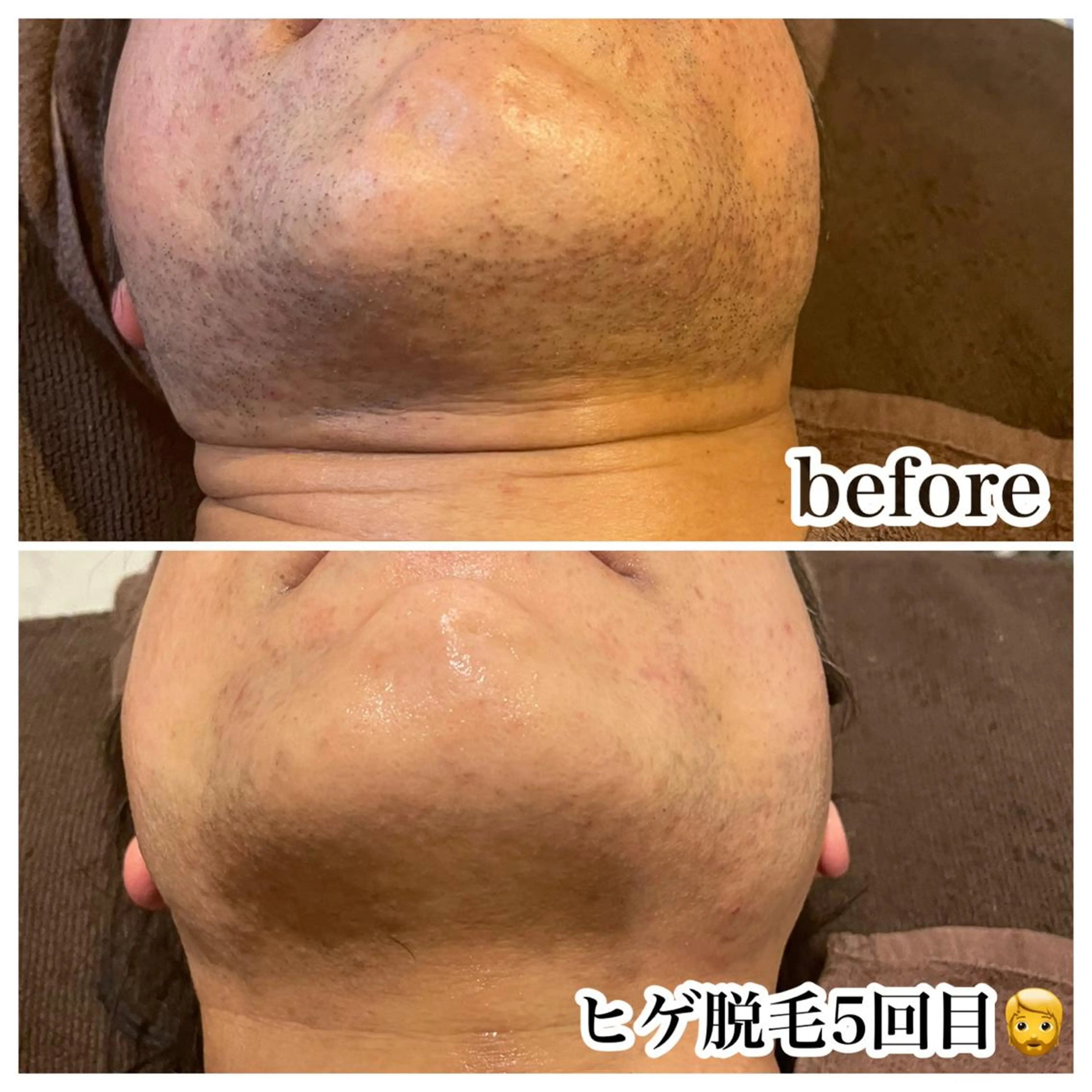 脱毛 浜野 恵美のエステ・リラクイメージ