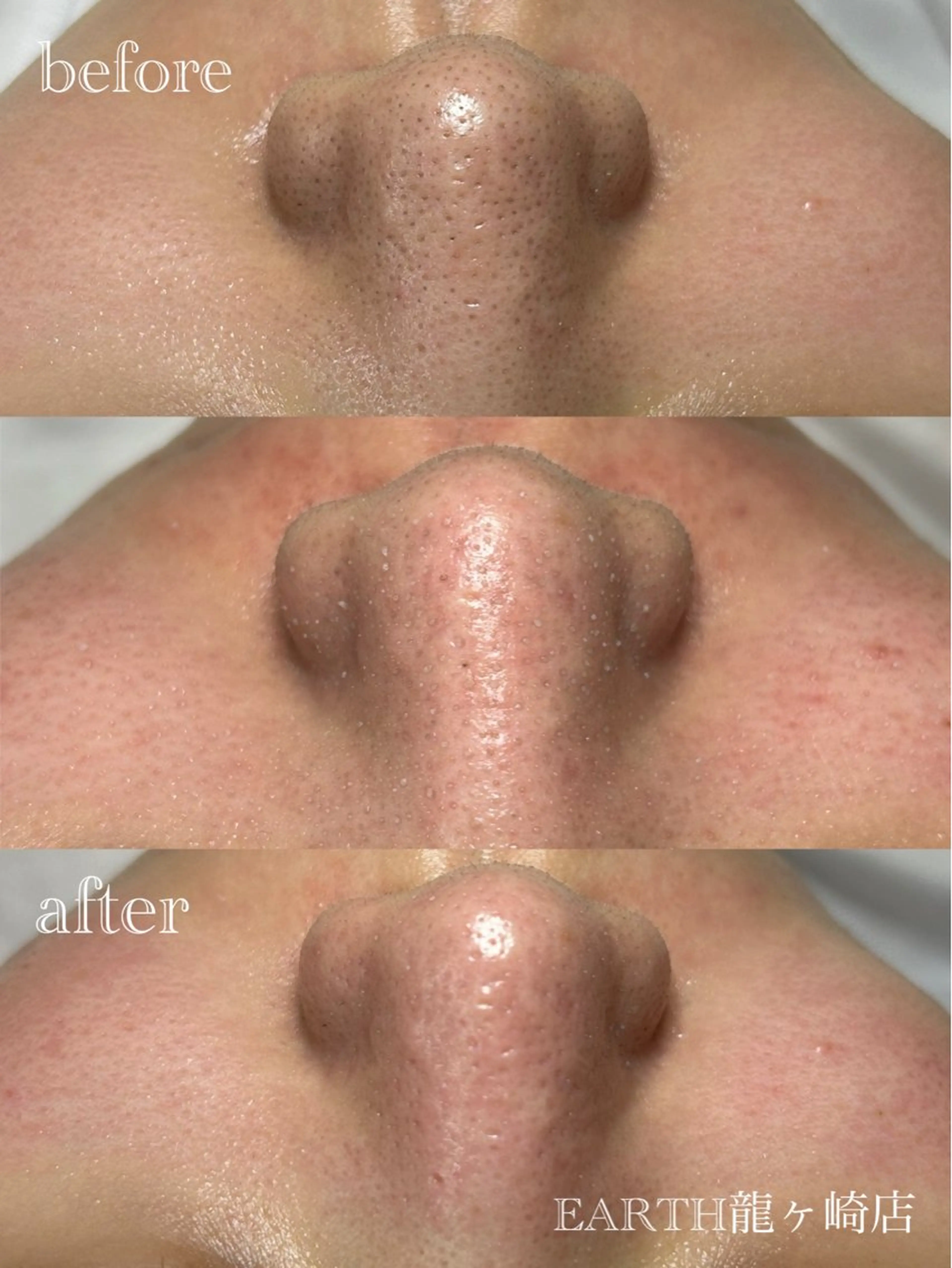 エステ リラク earth龍ヶ崎/ 脱毛/シミ取り🆕のエステ・リラクイメージ