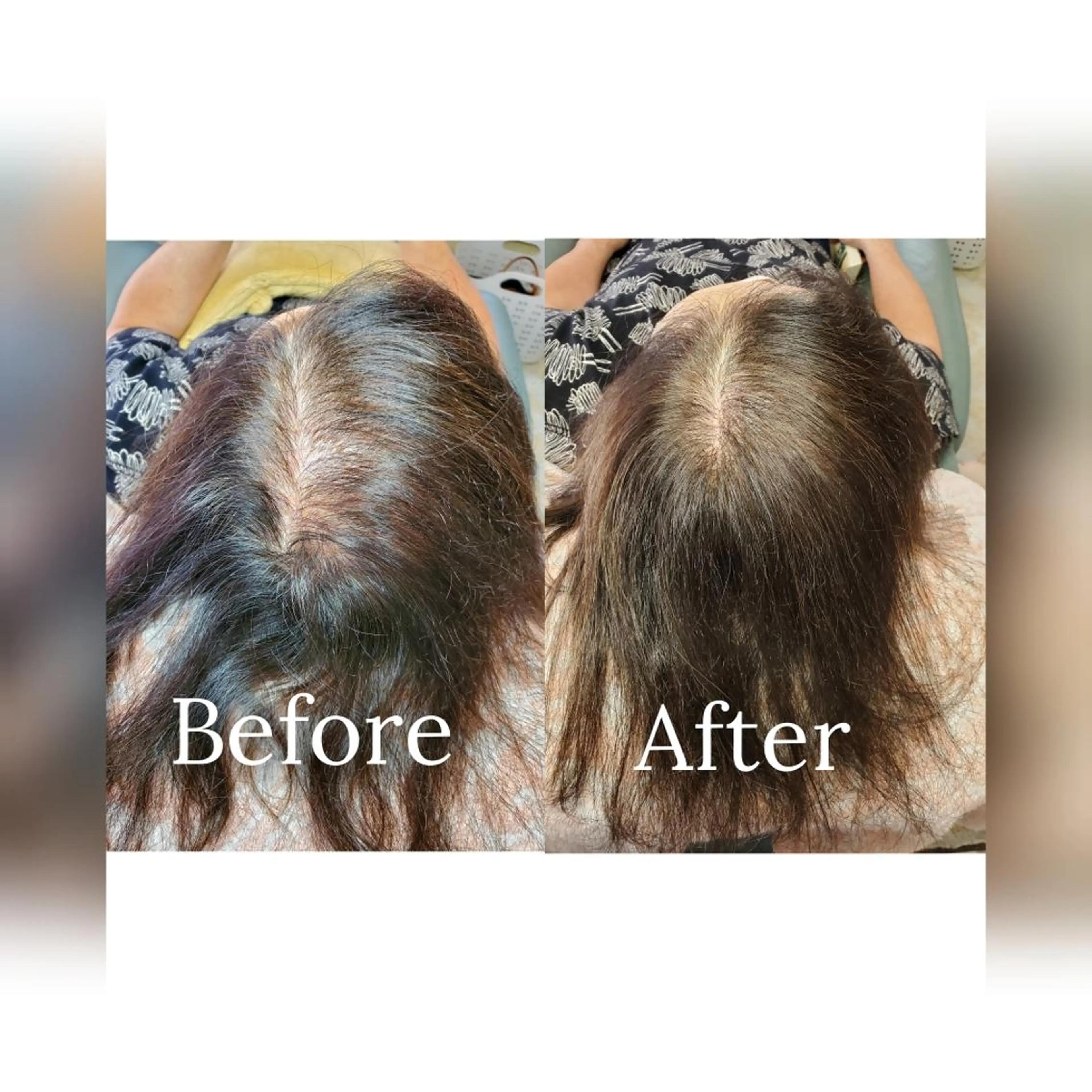 歯科提携セルフダック 宇都宮駒生店のエステ・リラクイメージ