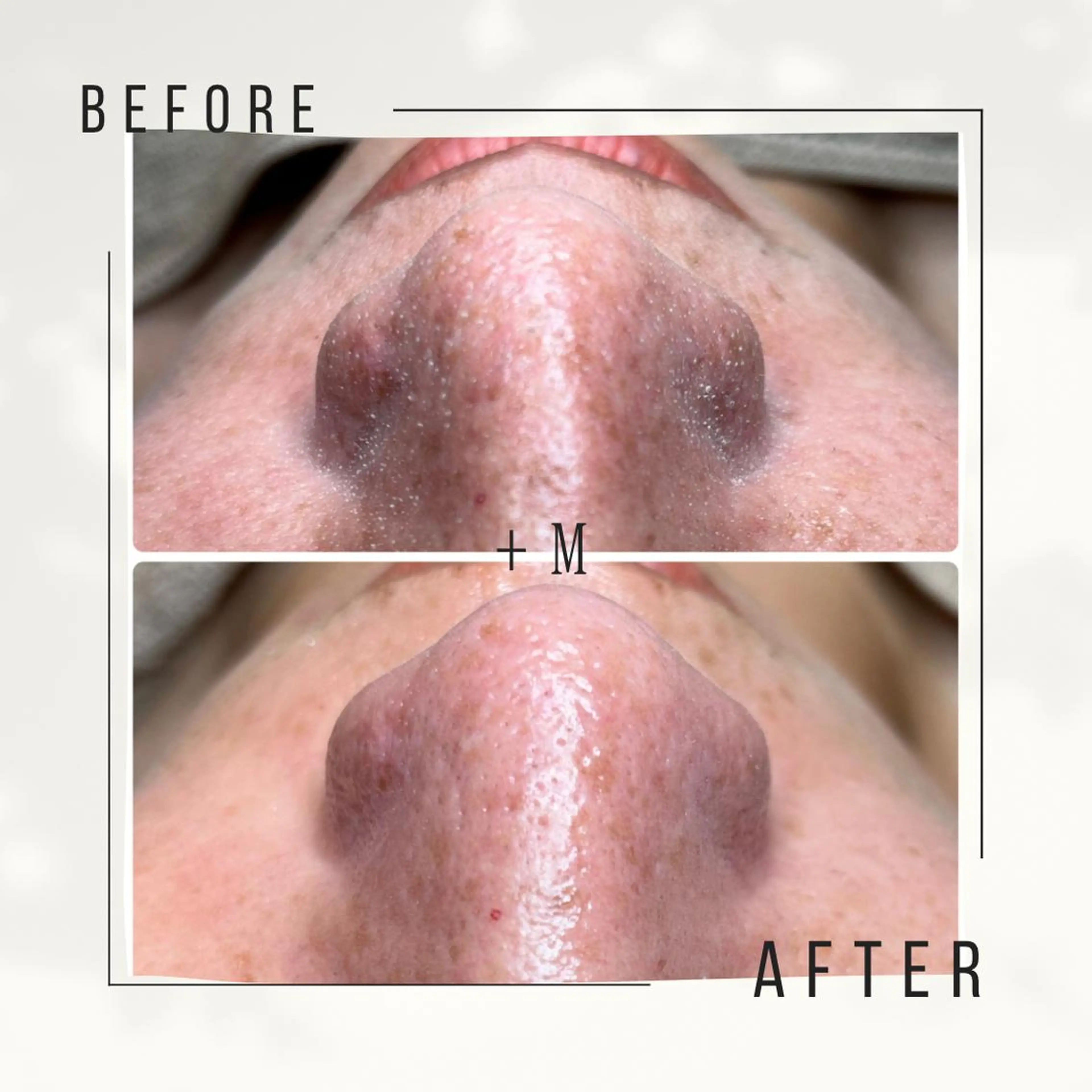 エステ リラク +M所属・竹ノ内 理恵のエステ・リラクイメージ