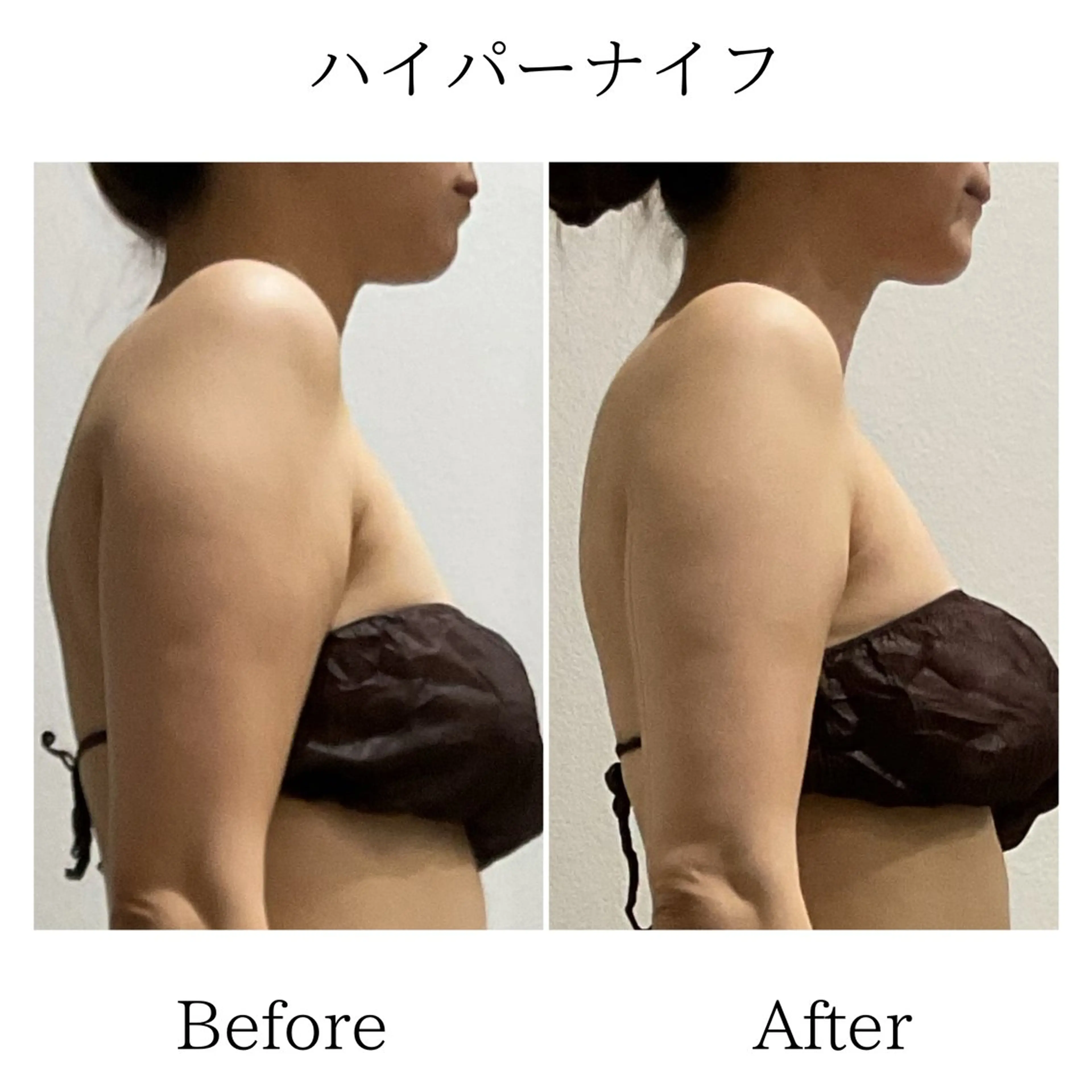 エステ LiLL by Andre beauty所属・LiLL 熊本のその他イメージ