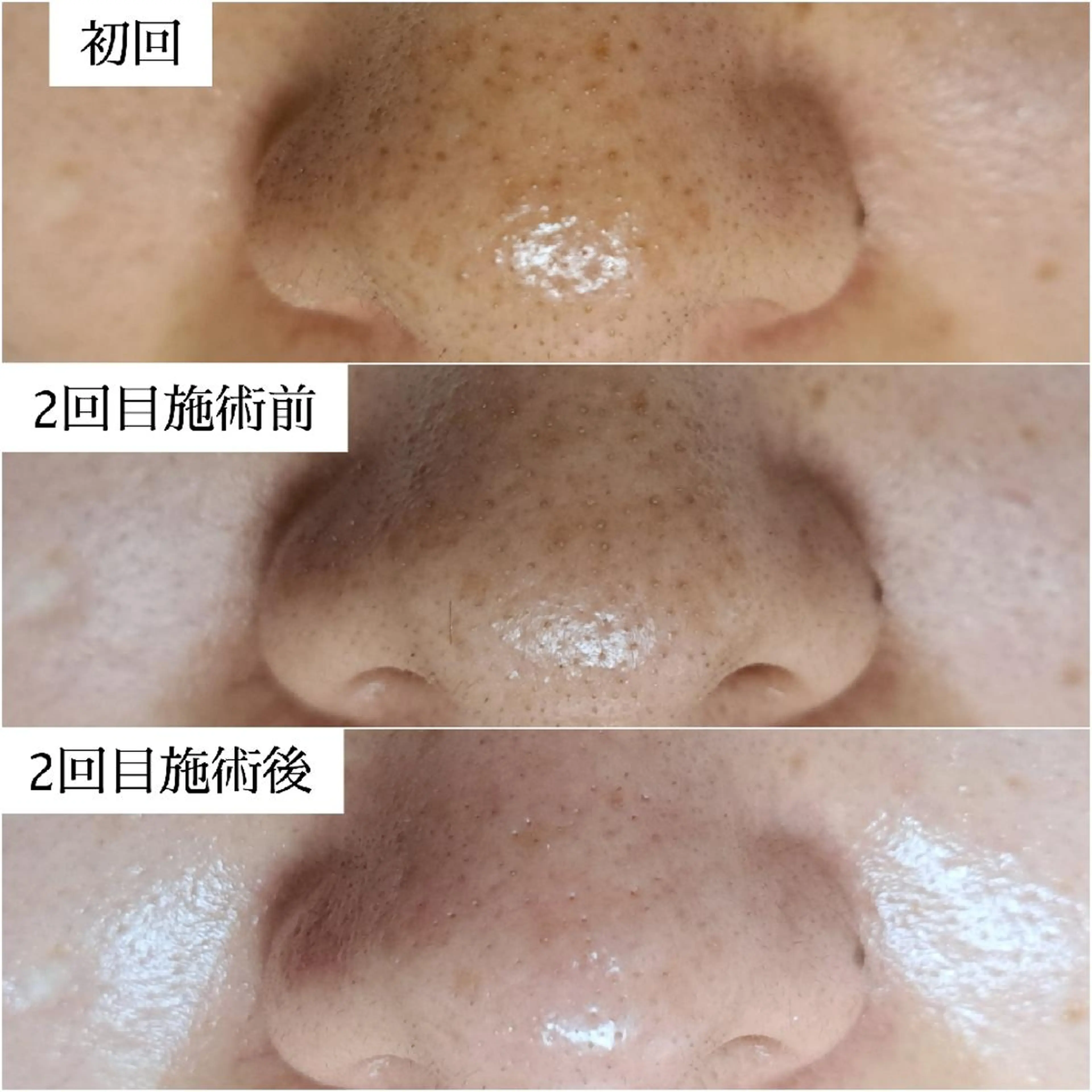 美肌脱毛サロン つるりと御殿場店所属・美肌脱毛サロン つるりとのその他イメージ