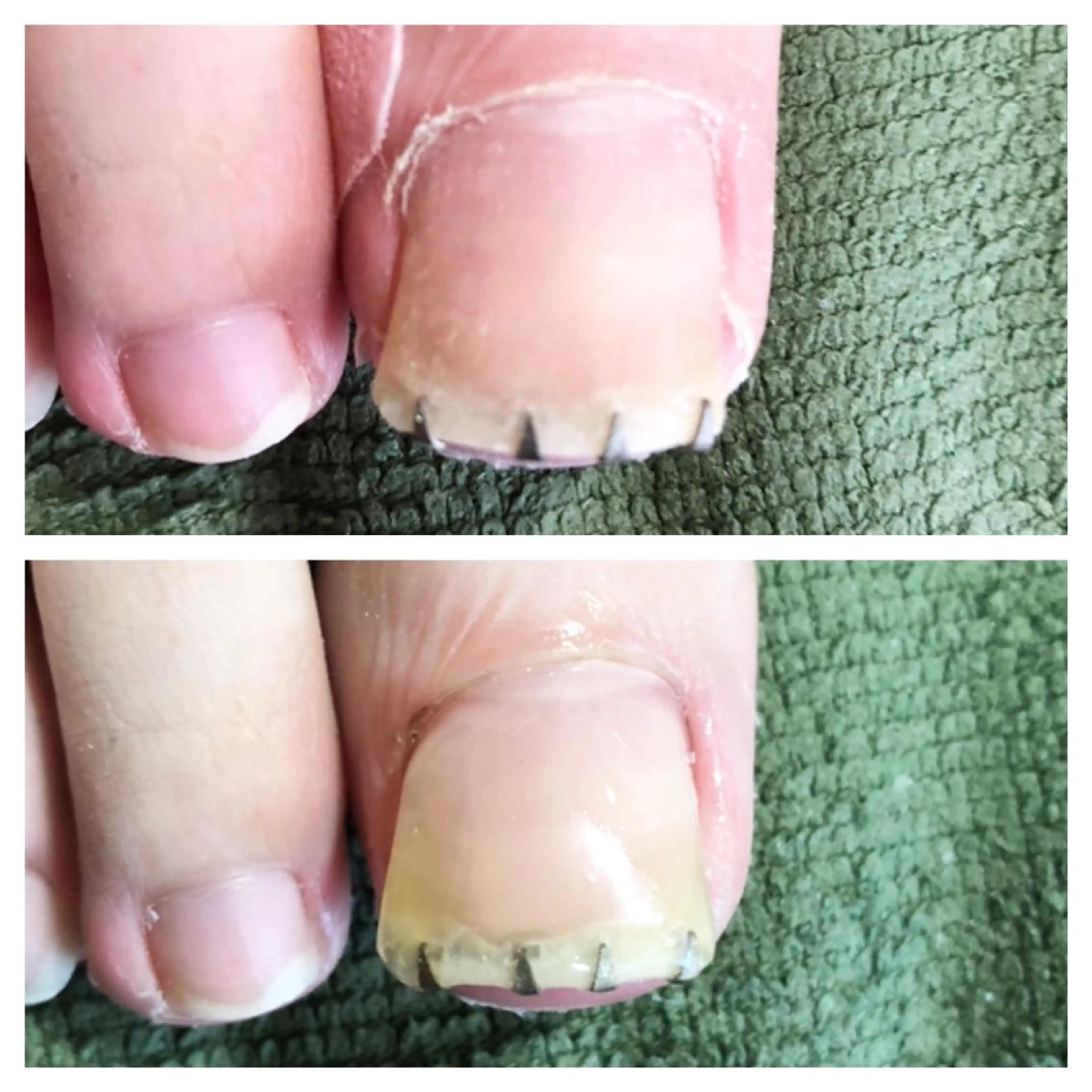 メンズ ネイル クリアネイル ジェルネイル 🌱 ま し お 🌱のその他イメージ