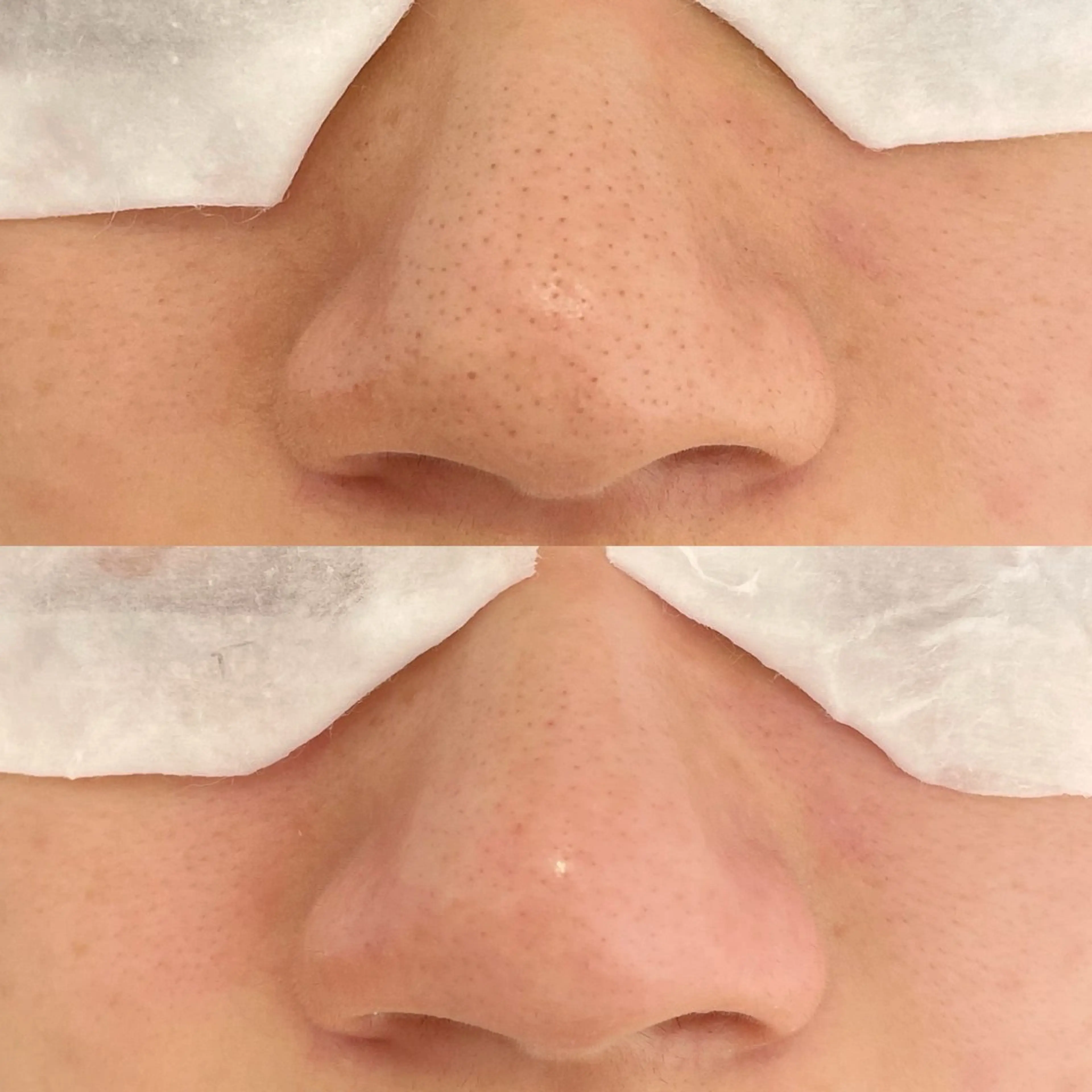 まつげ、毛穴 TREEのエステ・リラクイメージ