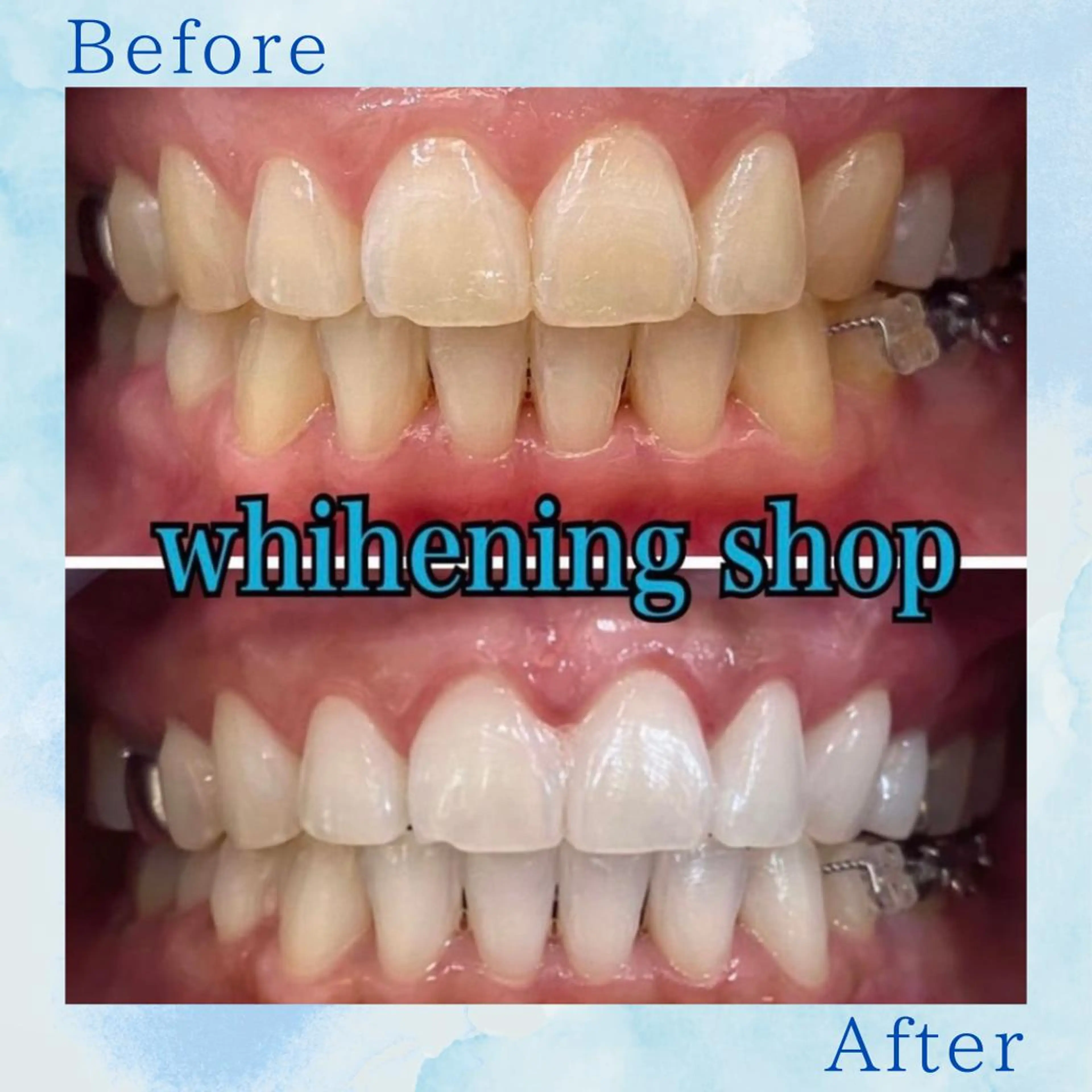 ホワイトニング ショップ葛西店のその他イメージ