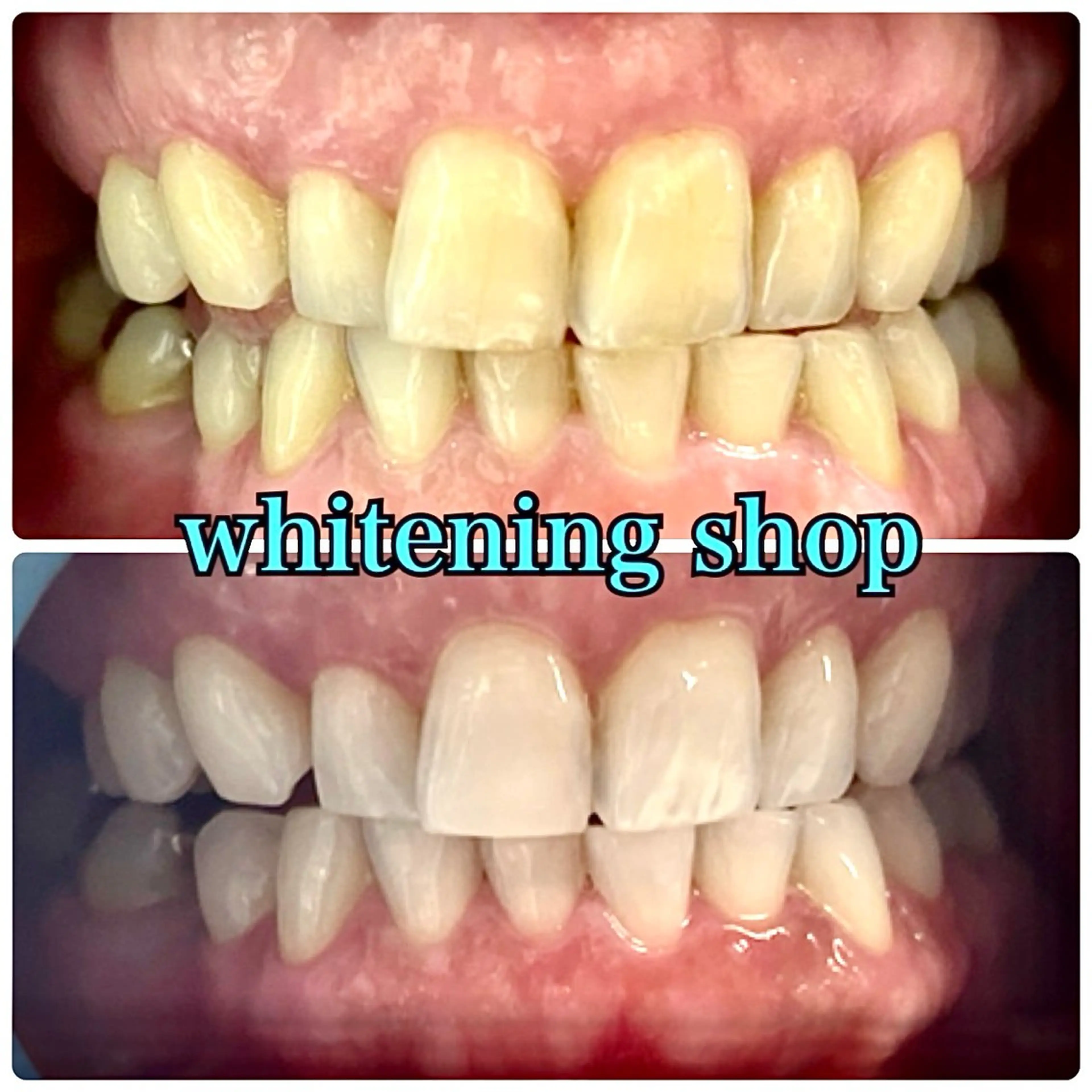 メンズ メンズパーマ エステ リラク ホワイトニング ショップ川越店のエステ・リラクイメージ