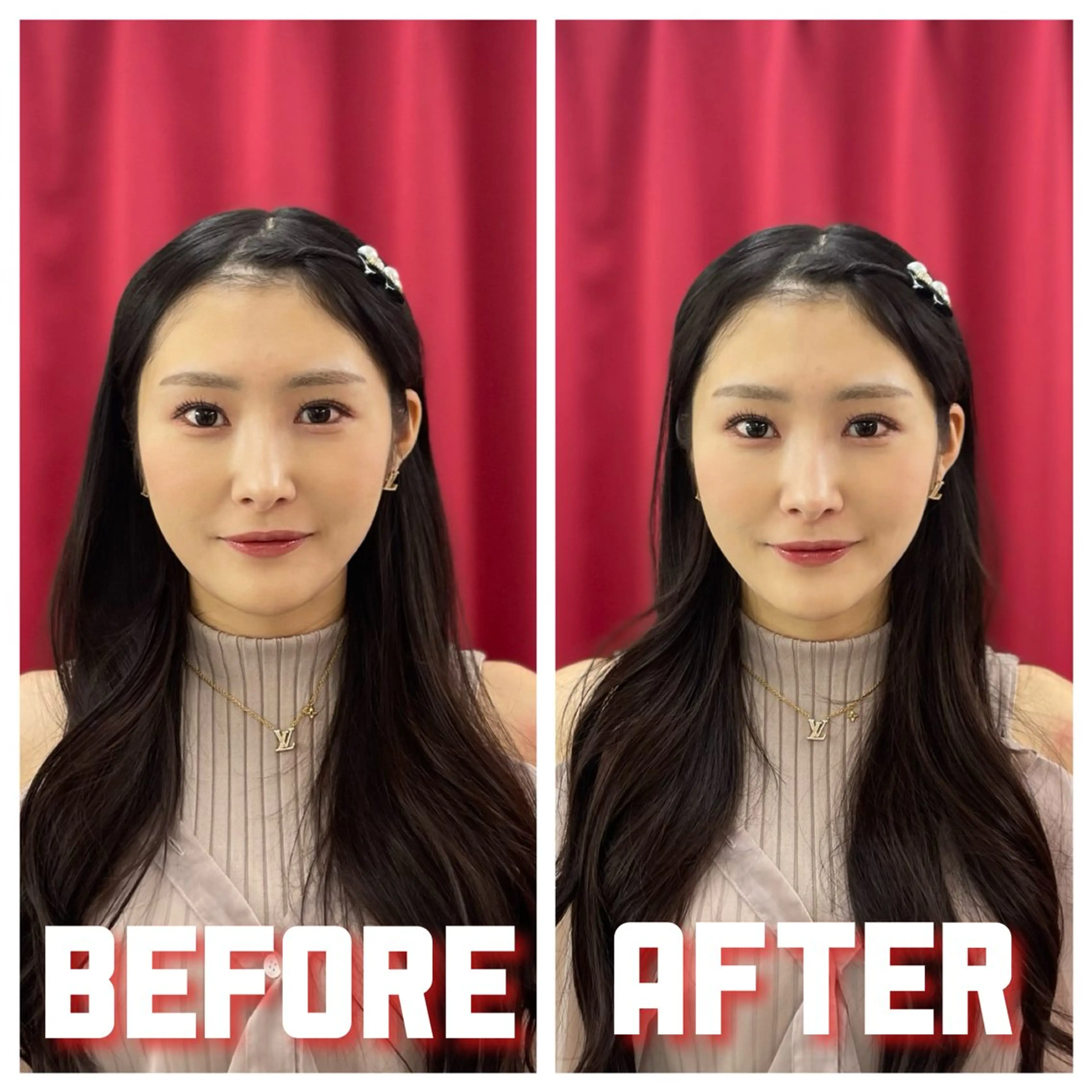 美容鍼 IKEZAKIのエステ・リラクイメージ