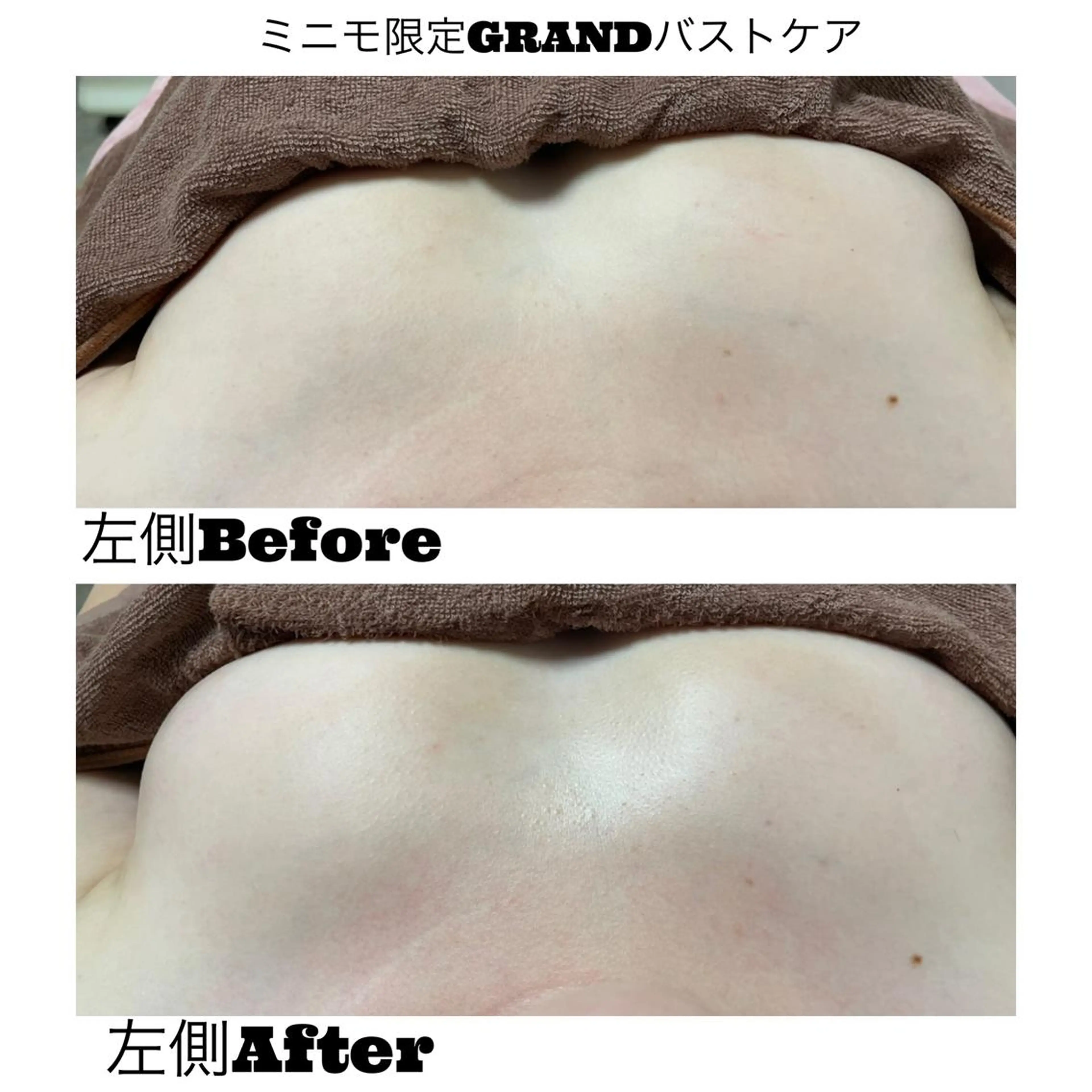 透明感の肌Lino malieのエステ・リラクイメージ