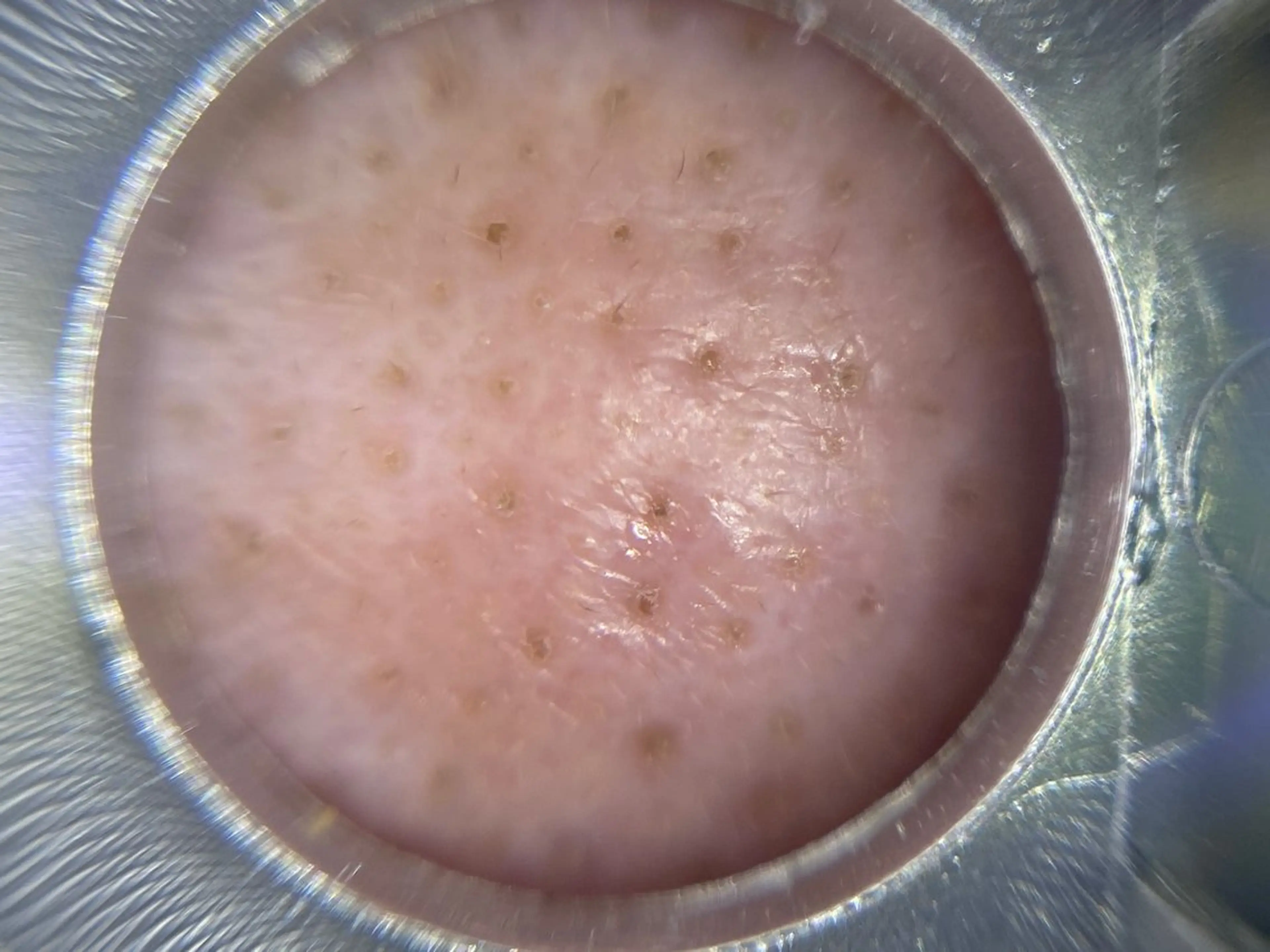 エステ シミケア専門店 &More所属・シミケア専門店 &Moreのエステ・リラクイメージ