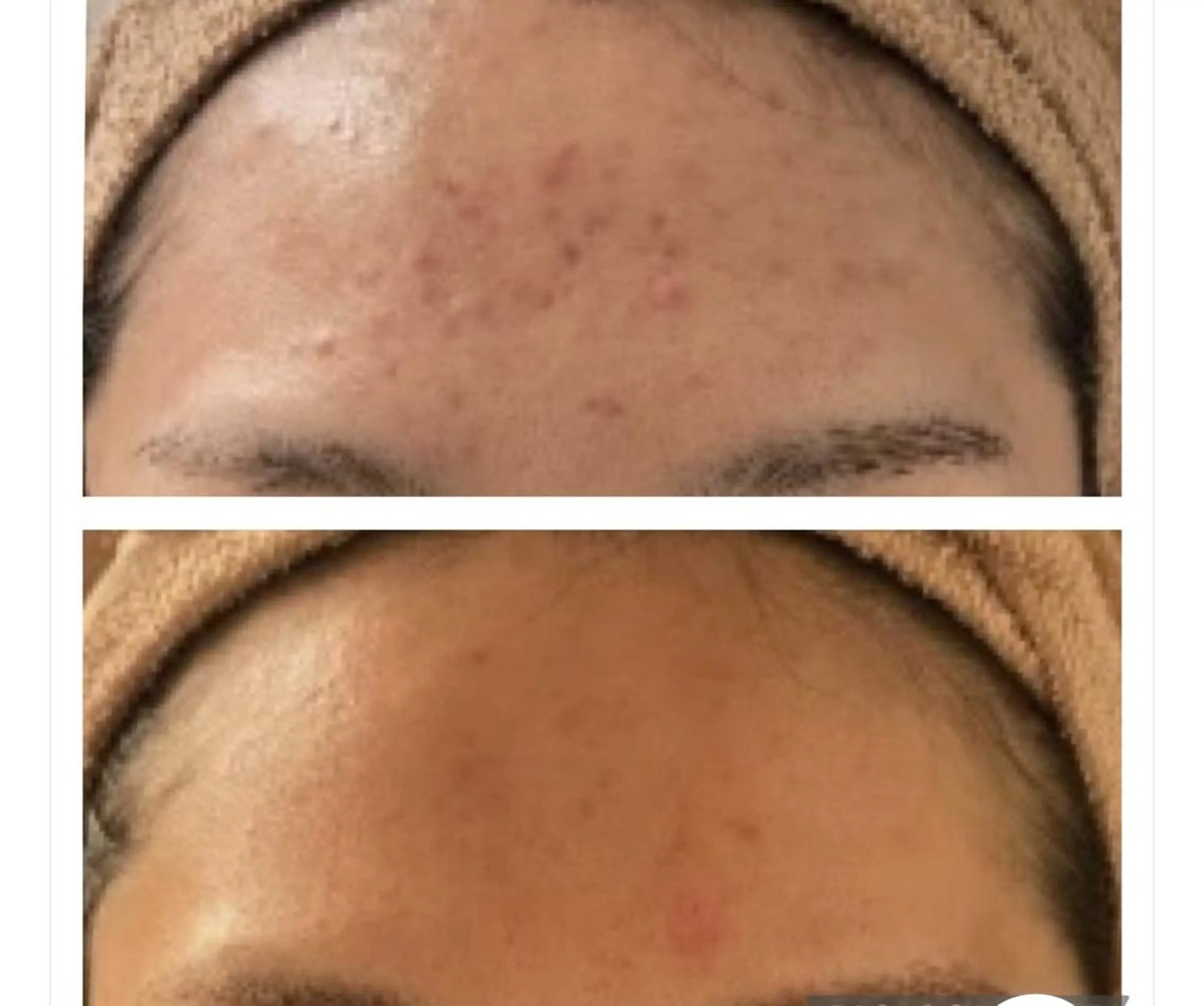 レイビス 渋谷店のエステ・リラクイメージ