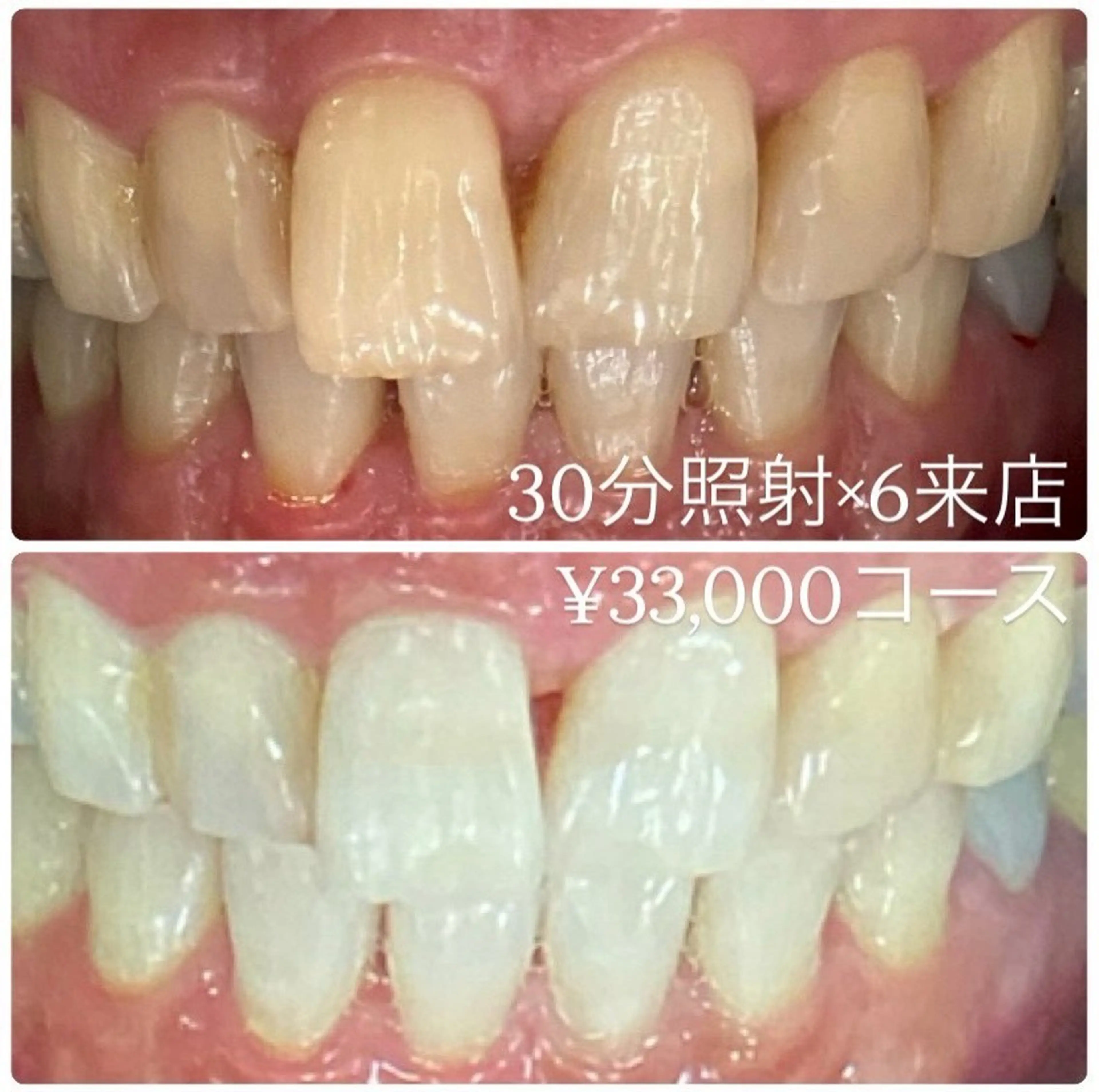 メンズ その他 ホワイトニングルーム　川崎店所属・ホワイトニング ルーム　川崎店のその他イメージ