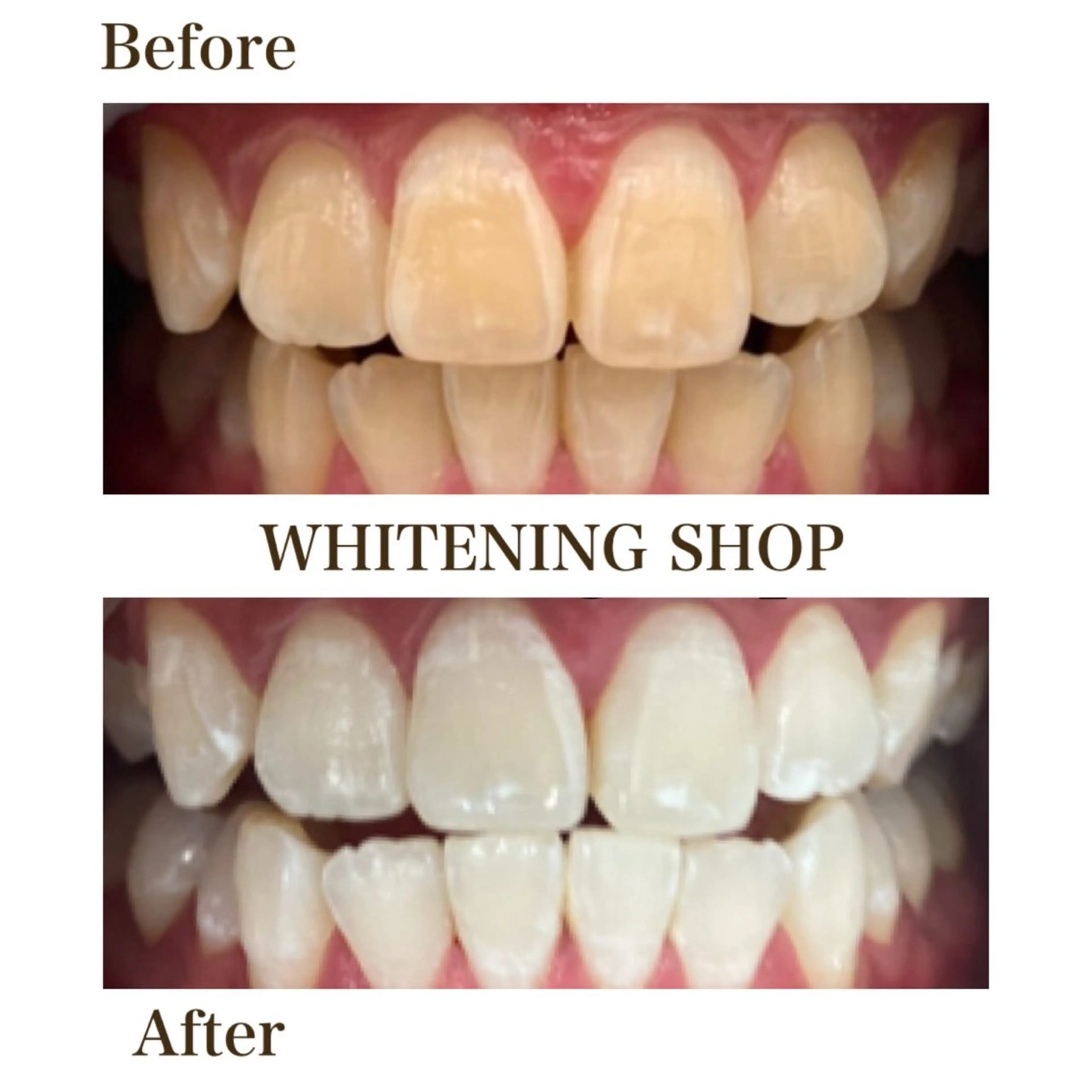 メンズ エステ リラク ホワイトニング ショップ川越店のエステ・リラクイメージ