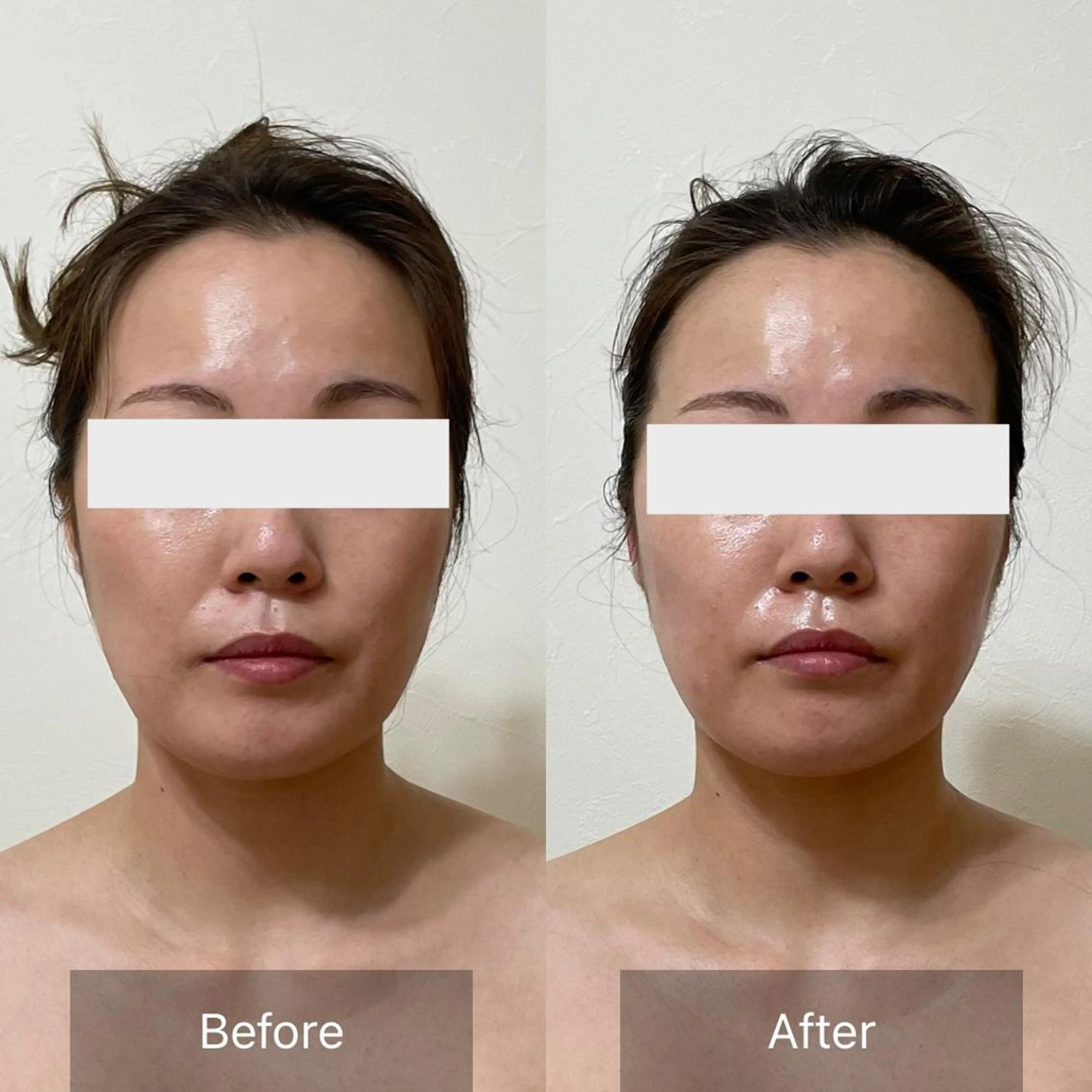 お顔のたるみ上がりすぎ注意⚠️WINBACKフェイシャル＆首肩コリケアの写真