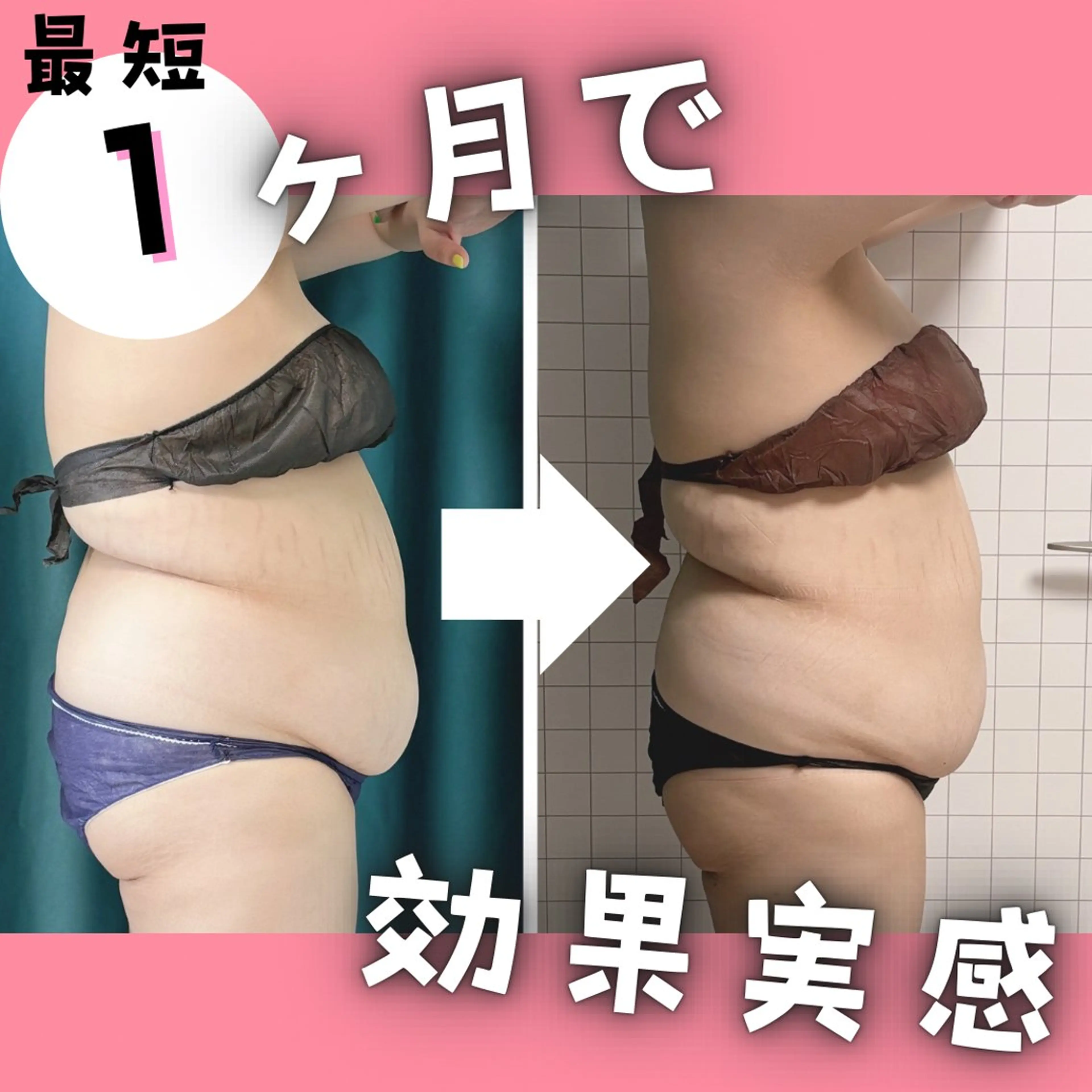 小顔矯正専門店 【RED】池田のエステ・リラクイメージ