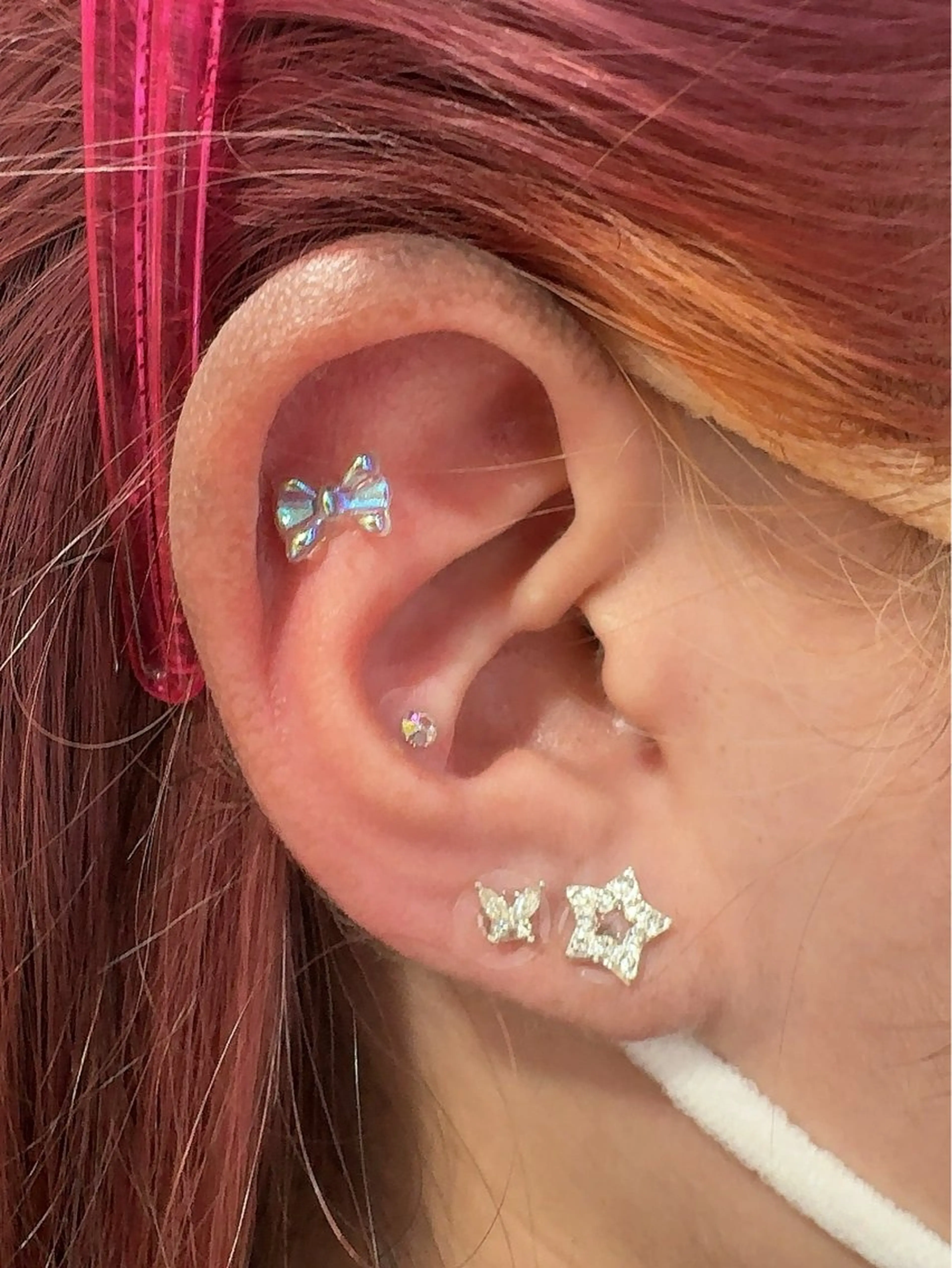 耳つぼジュエリー （両耳10粒まで）の写真