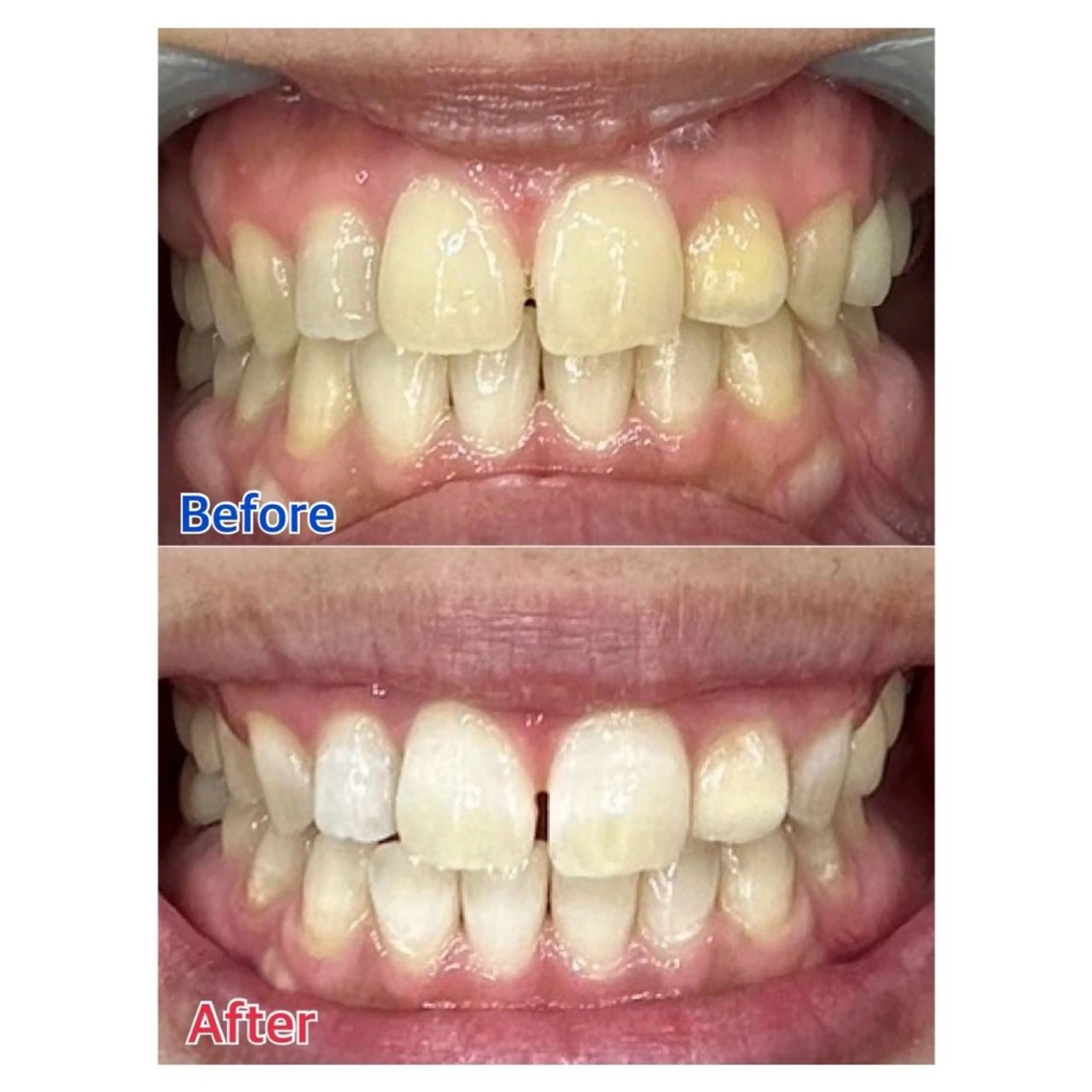 MBEAUTYSALON 千葉店・京成大久保所属・Melty 輝のその他イメージ