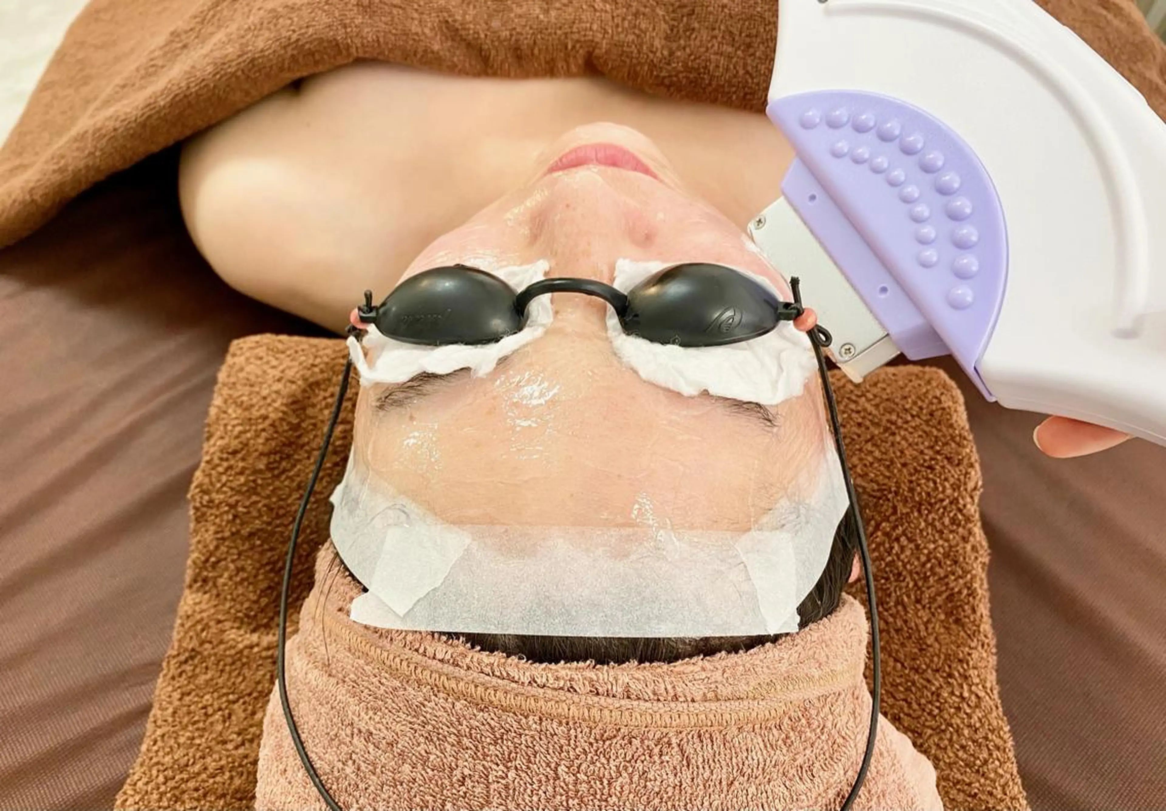 【体験】お顔の脱毛体験♪ 初回カウンセリング込みの写真