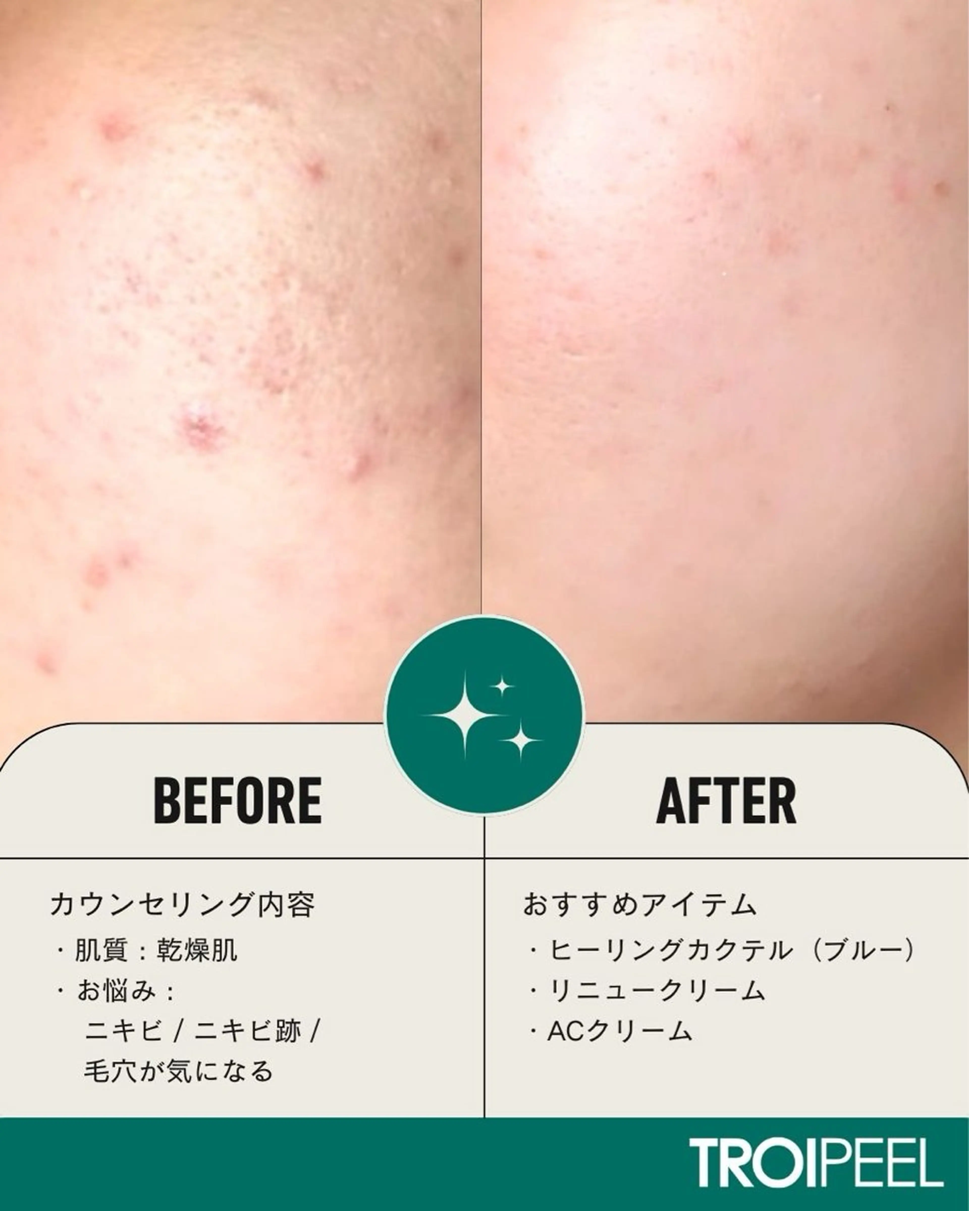 エステ salonCOCO所属・肌管理看護師💎 salonCOCOのエステ・リラクイメージ